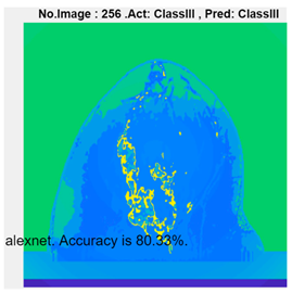 Micromachines 13 02049 i008