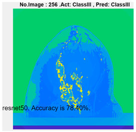Micromachines 13 02049 i009
