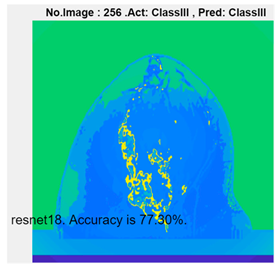Micromachines 13 02049 i010
