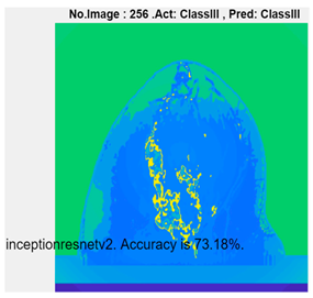 Micromachines 13 02049 i011