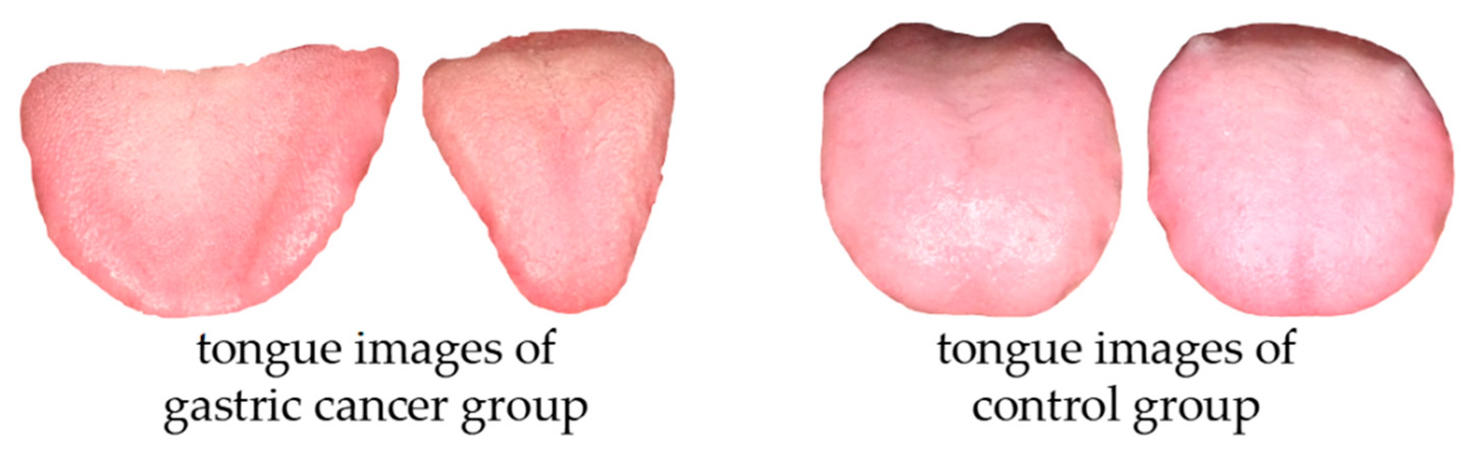 Micromachines 14 00053 g008