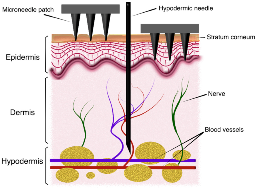 Micromachines 14 00133 g001