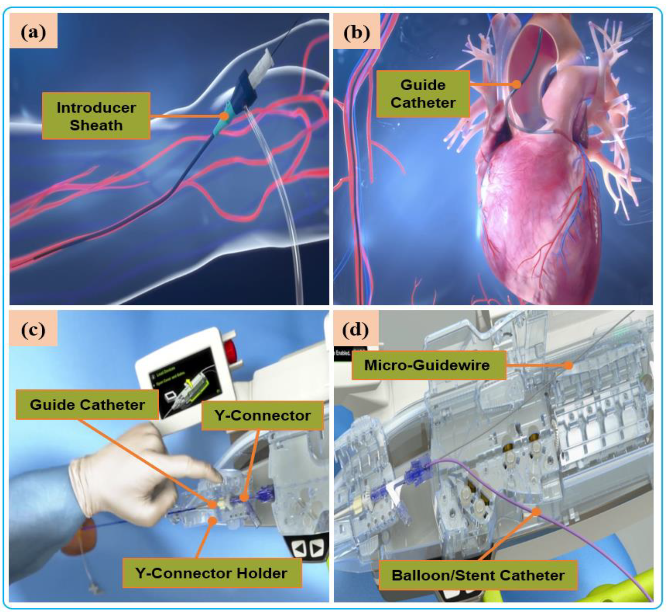 Micromachines 14 00197 g004
