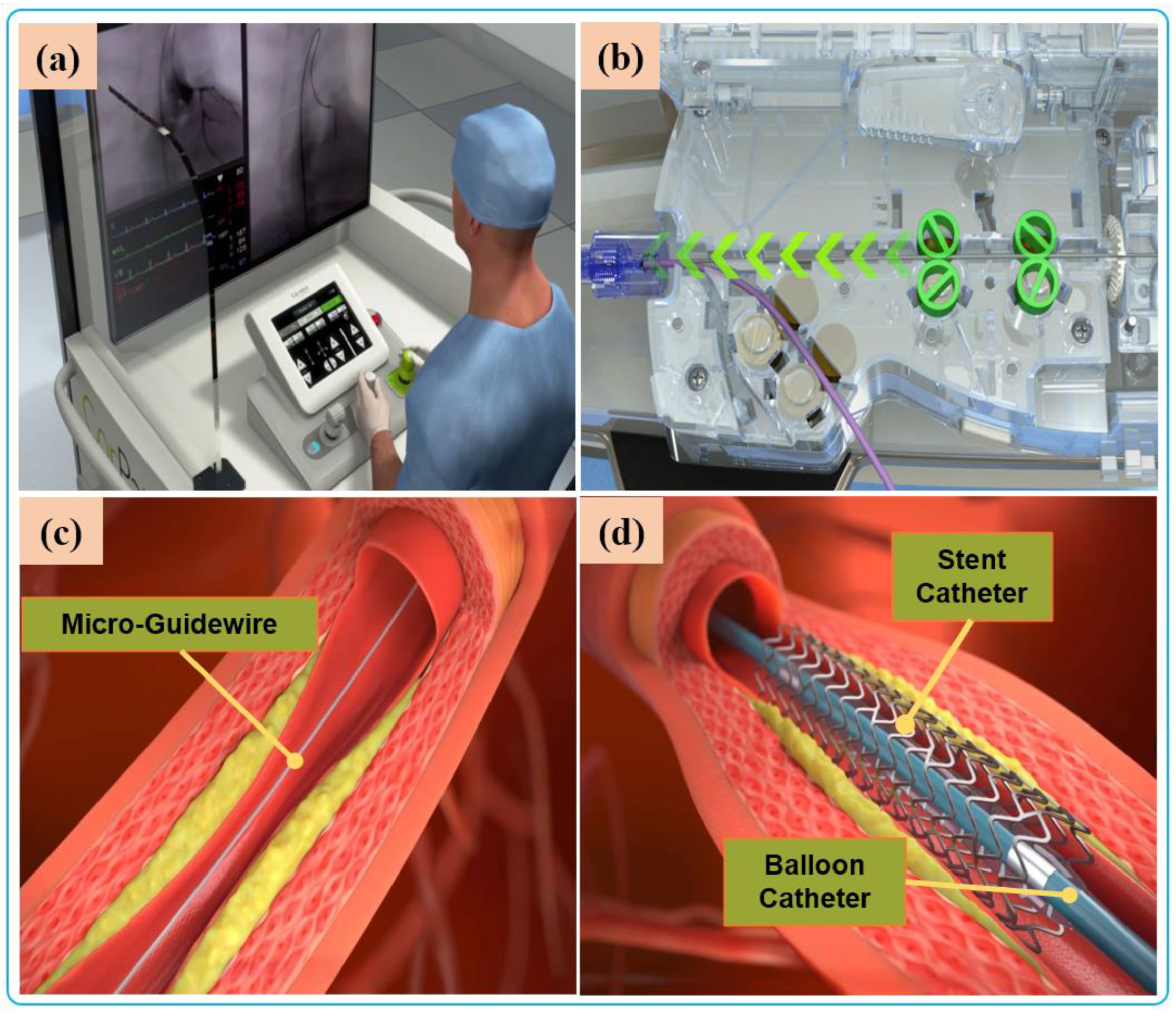 Micromachines 14 00197 g005