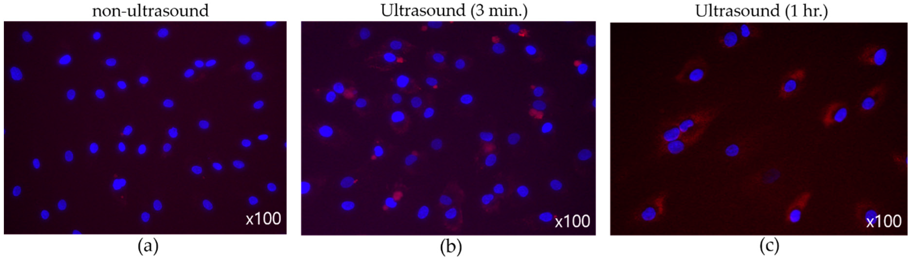 Micromachines 14 00202 g011