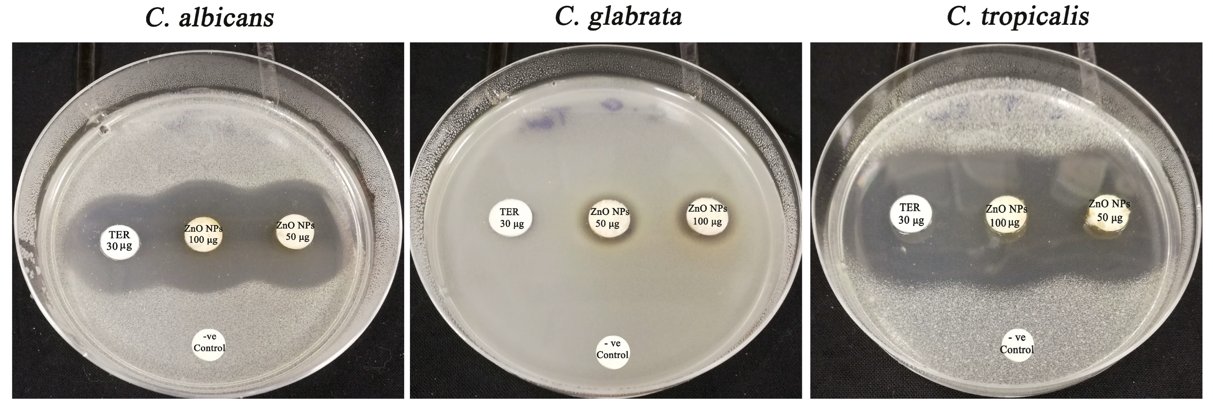 Micromachines 14 00209 g011