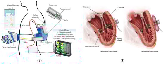 Micromachines 14 00359 g005b