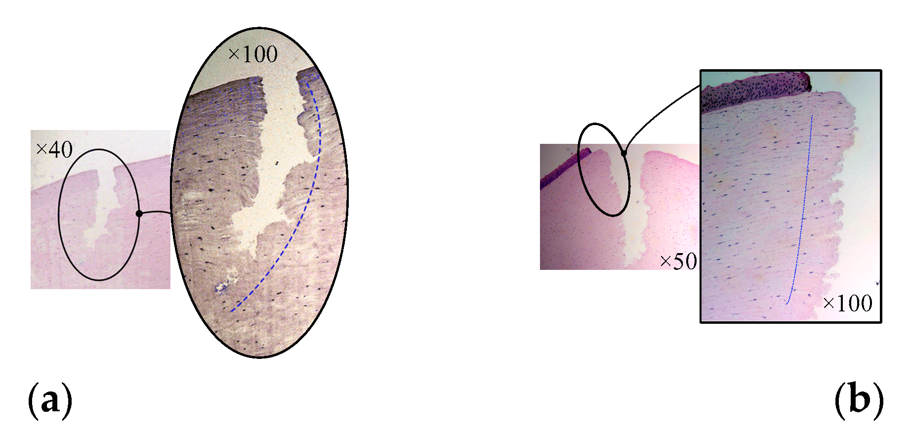 Micromachines 14 00438 g017