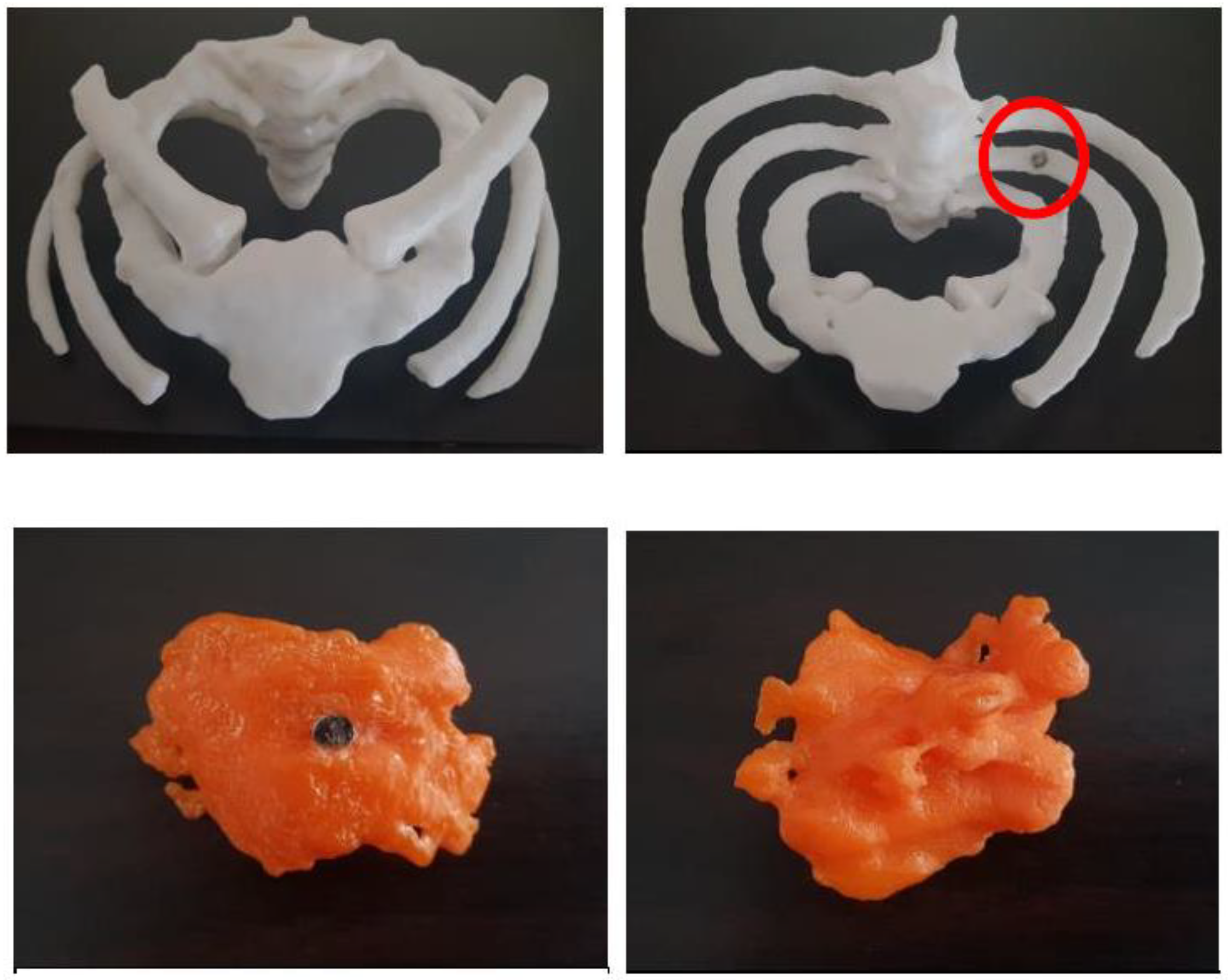 Micromachines 14 00464 g018a