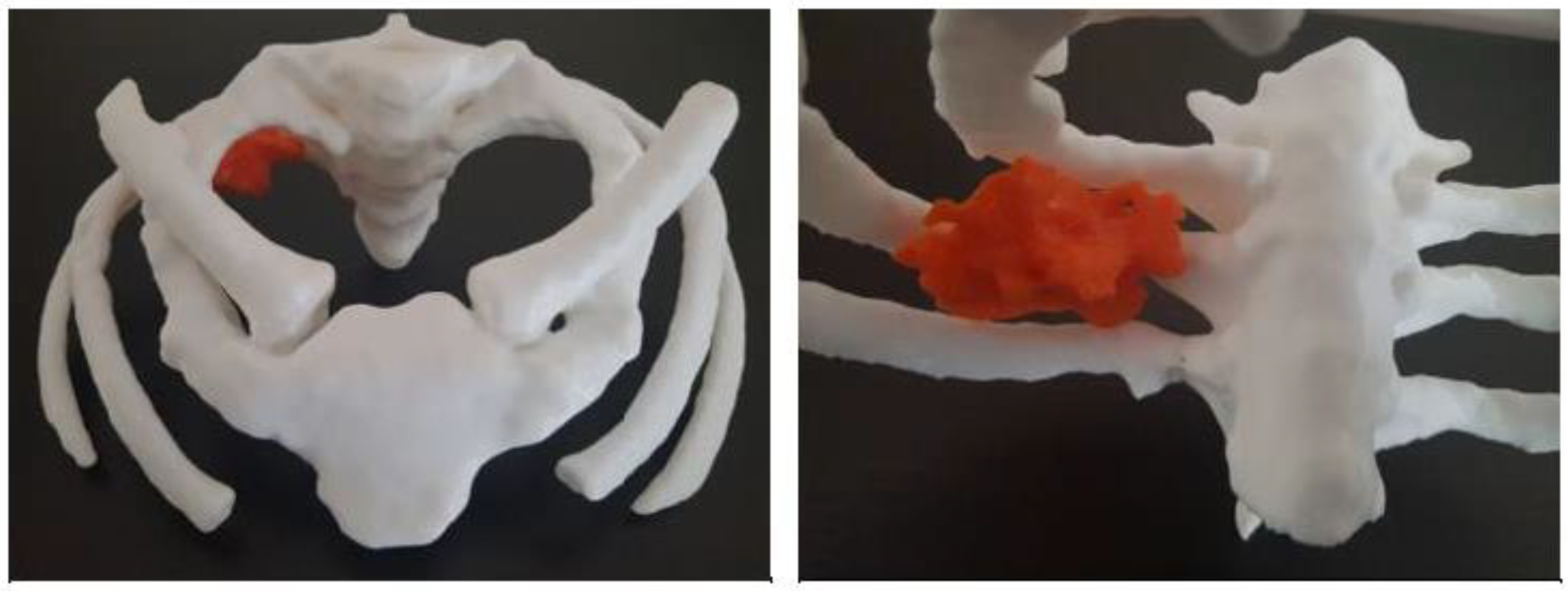 Micromachines 14 00464 g018b