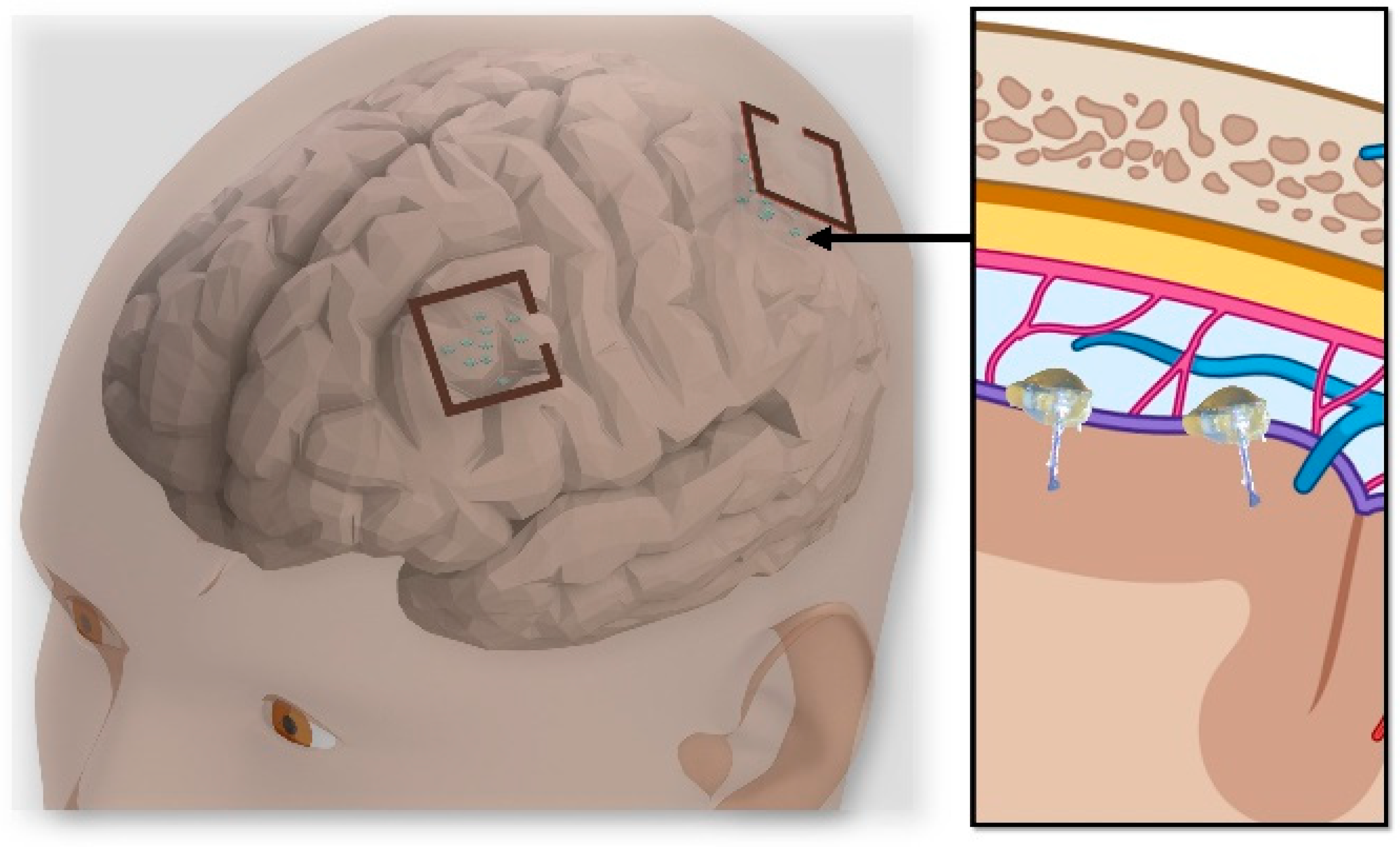 Micromachines 14 00476 g001