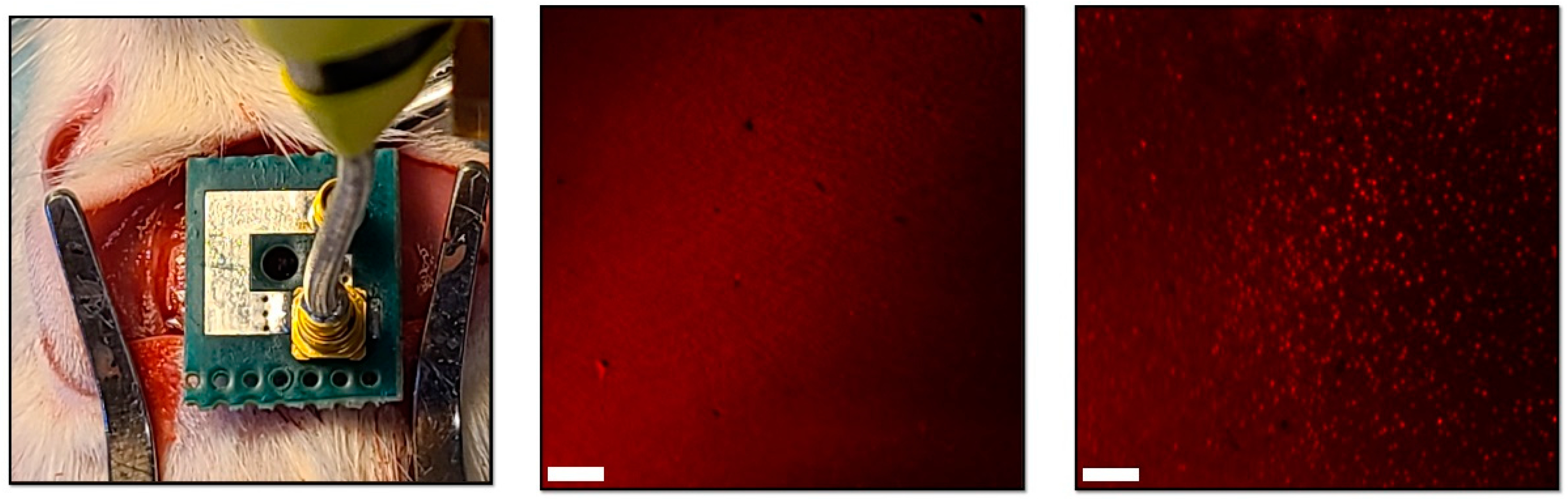 Micromachines 14 00476 g009