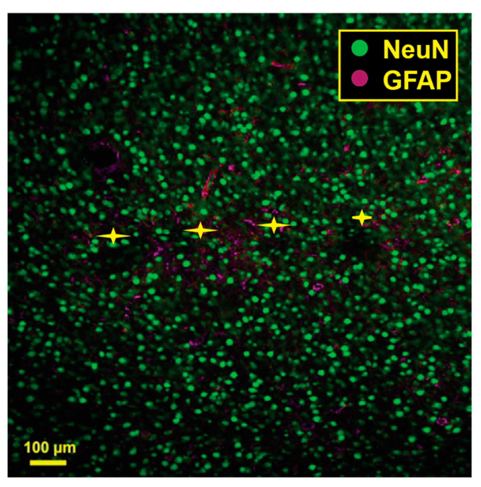 Micromachines 14 00680 g005