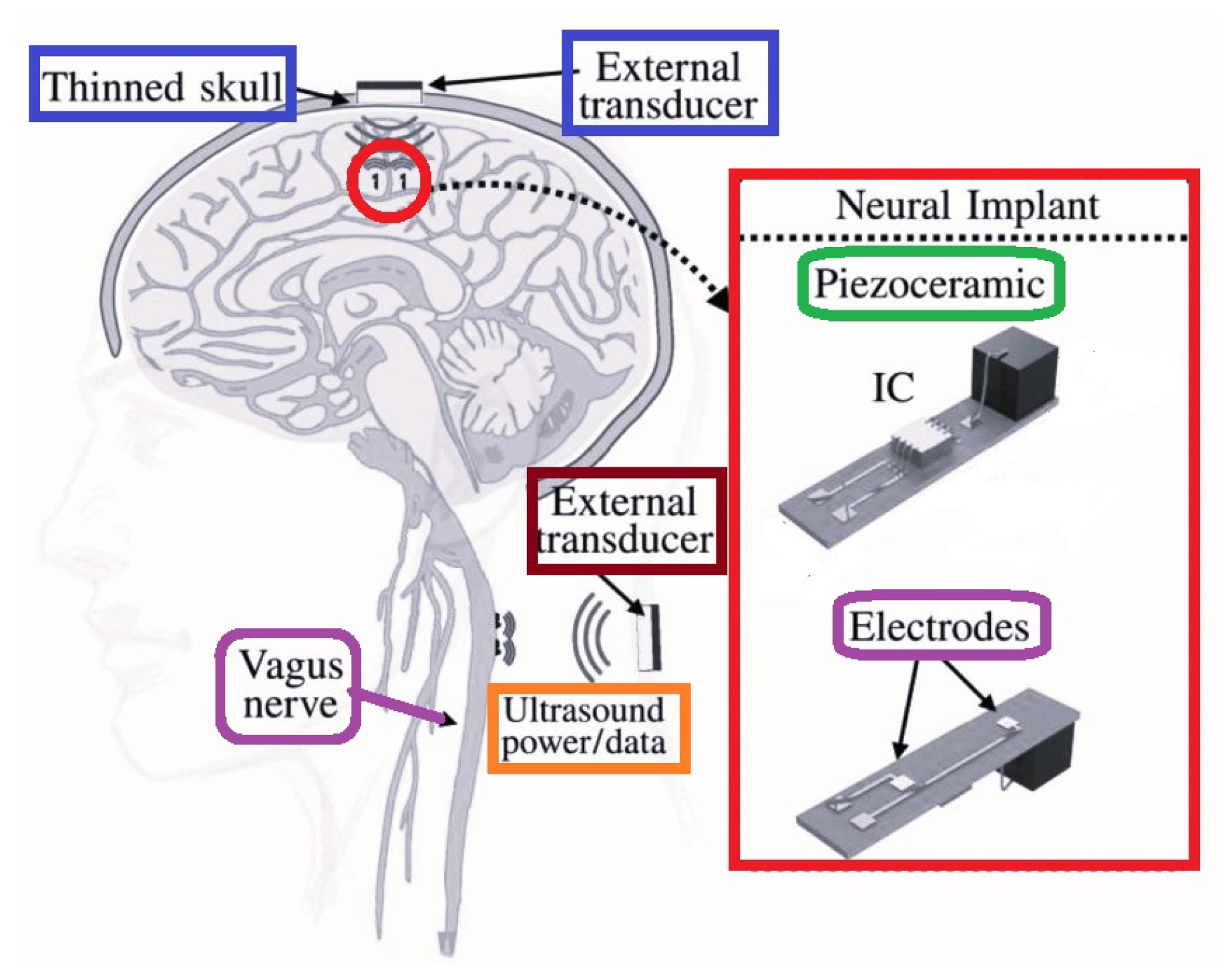 Micromachines 14 00786 g029