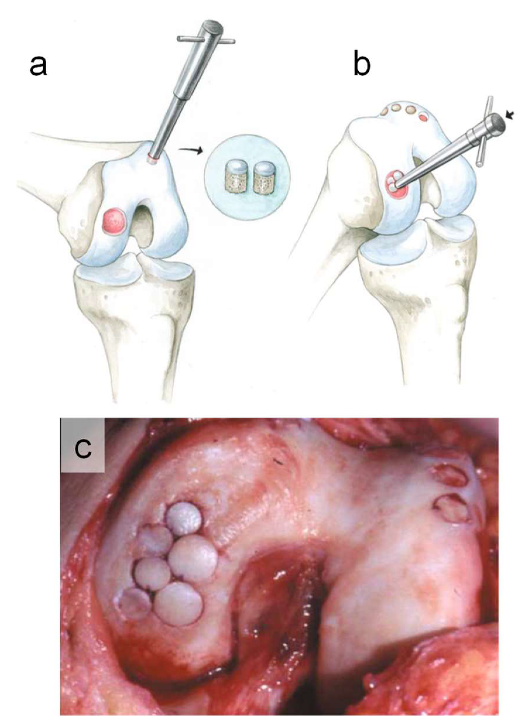 Micromachines 14 00856 g001