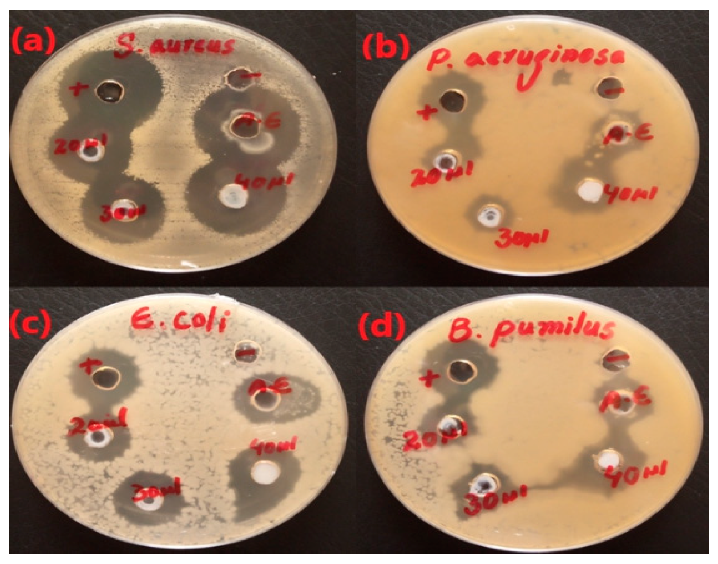 Micromachines 14 00928 g008