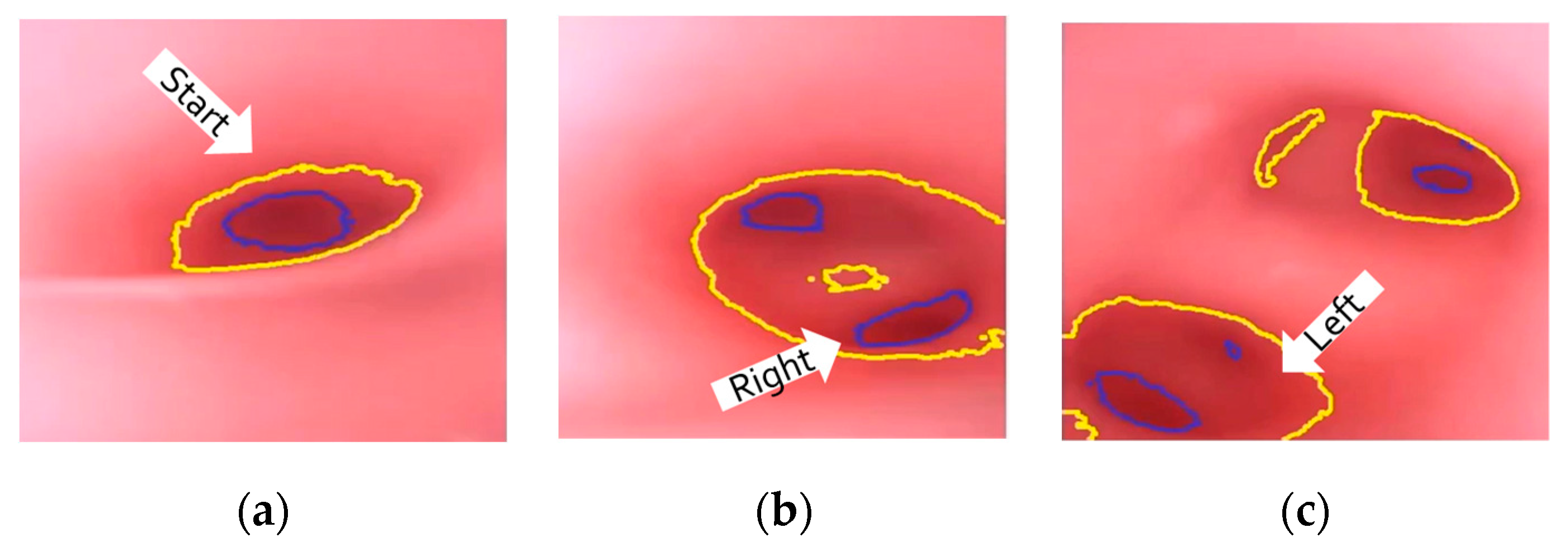 Micromachines 14 00969 g017a