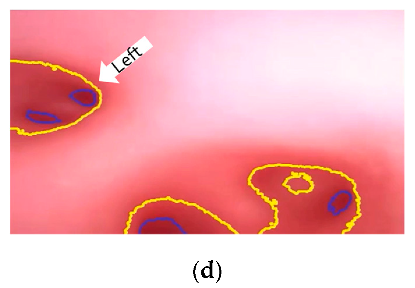 Micromachines 14 00969 g017b