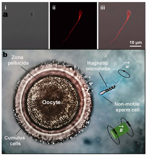 Micromachines 14 00983 g003