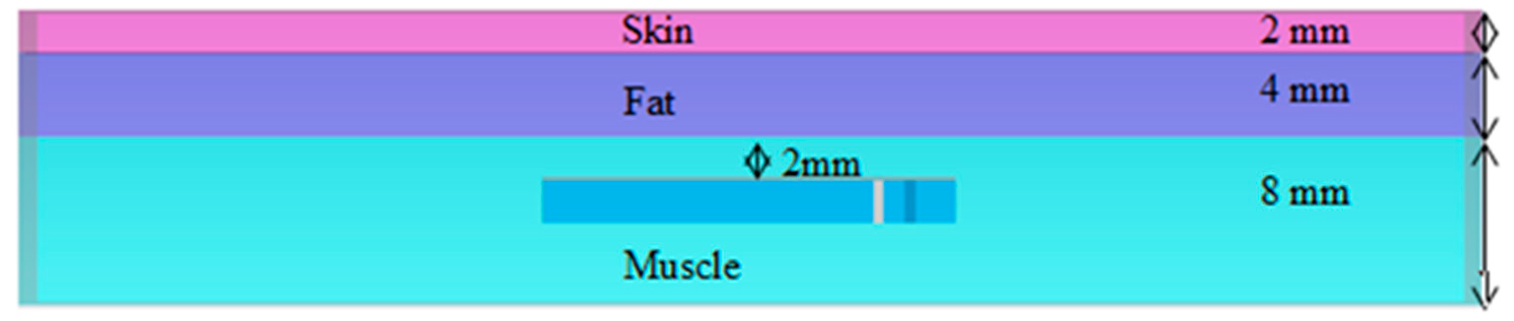 Micromachines 14 01021 g002