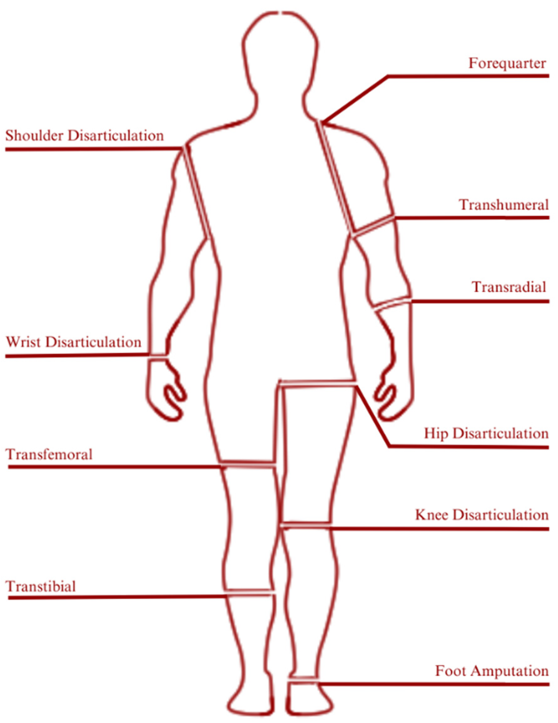 Micromachines 14 01165 g012