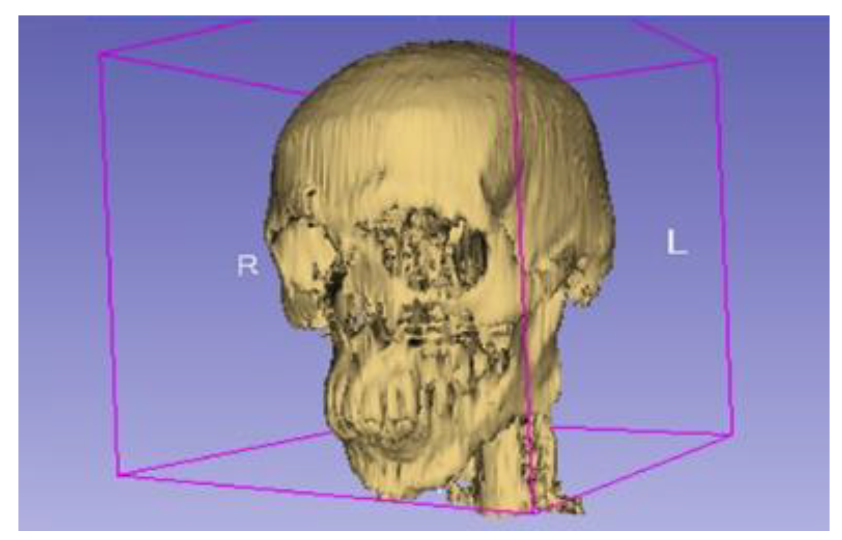 Micromachines 14 01646 g001