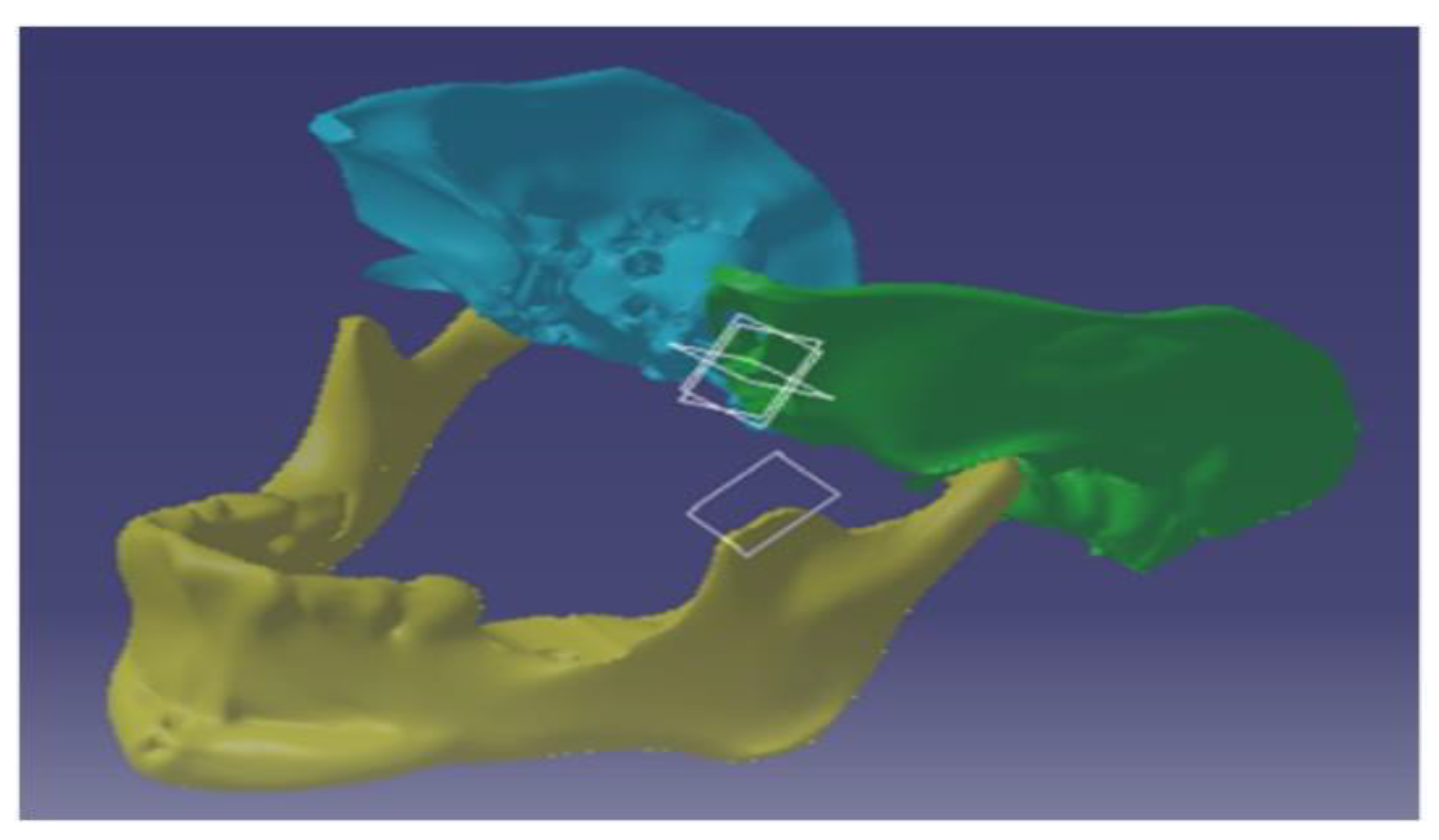 Micromachines 14 01646 g002