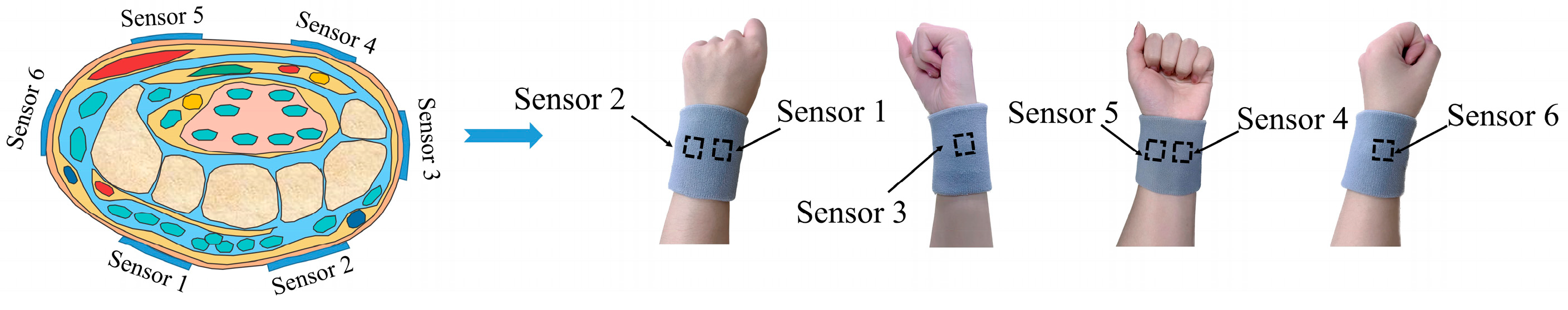 Micromachines 15 00185 g006