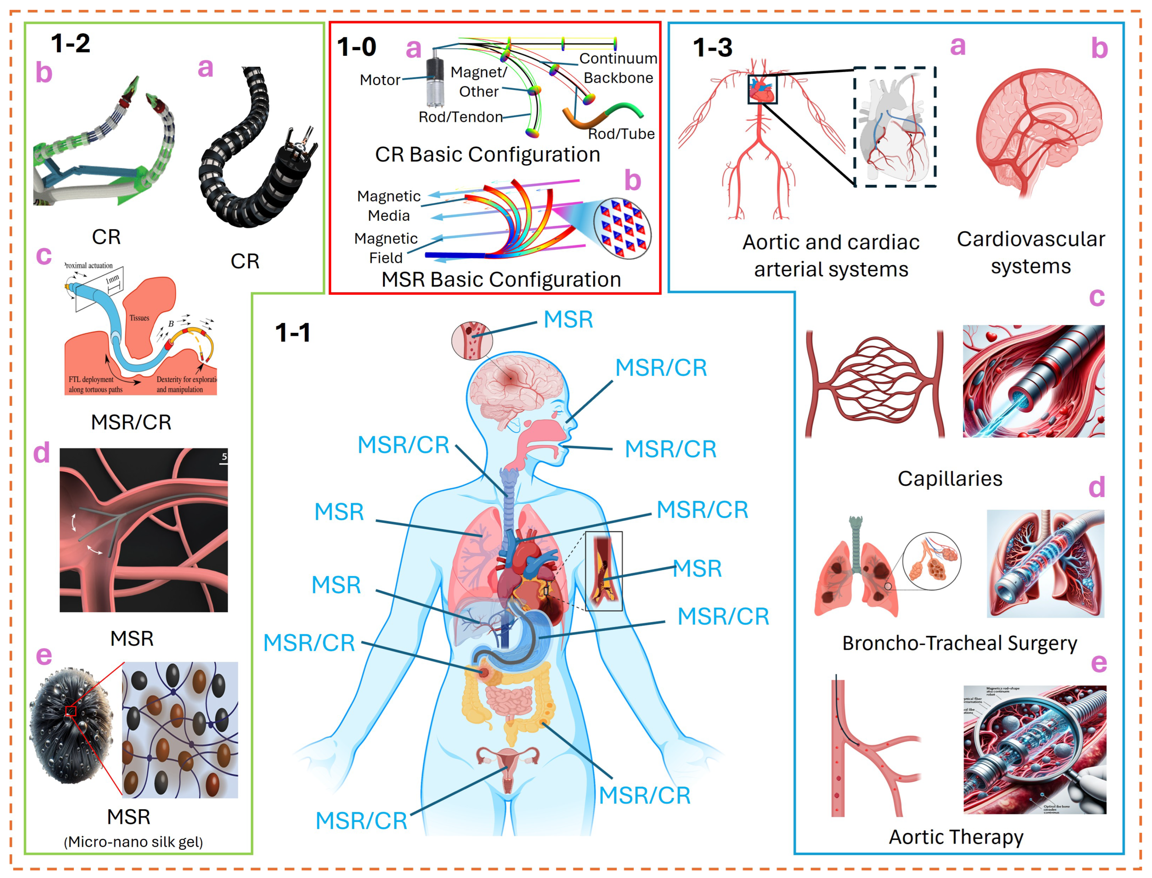 Micromachines 15 00313 g001
