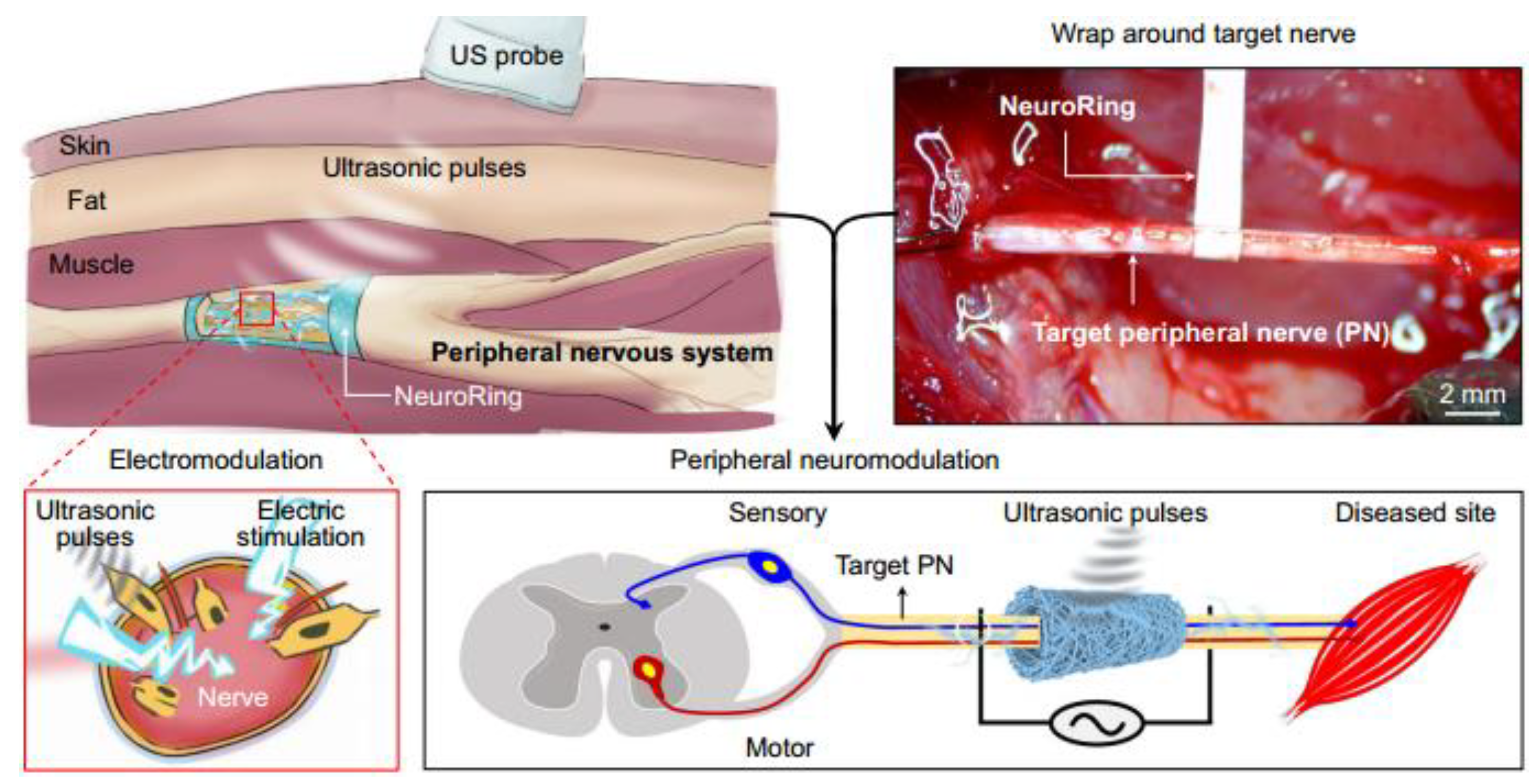 Micromachines 15 00982 g044