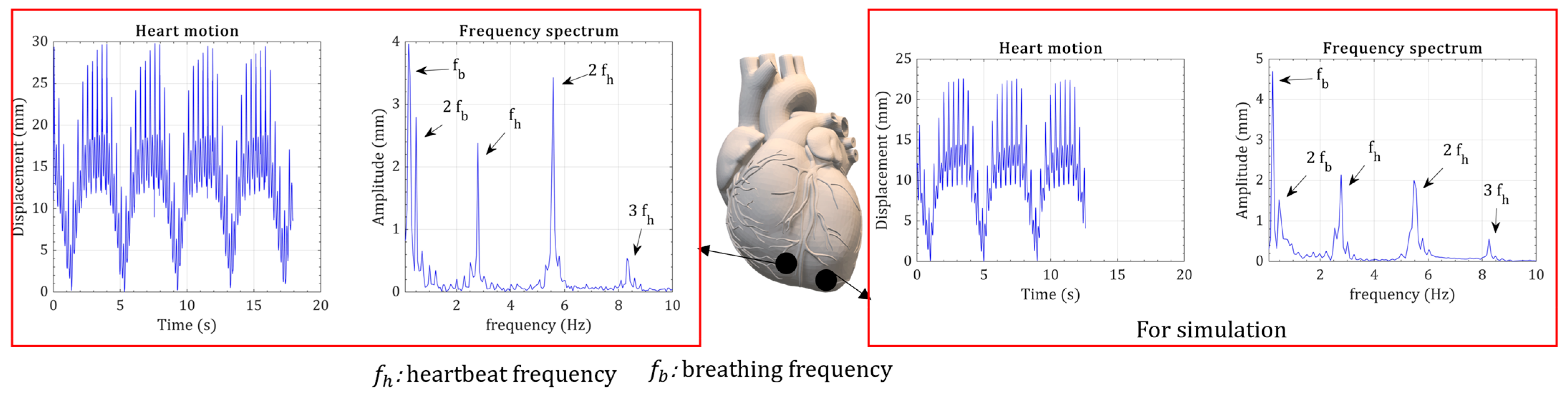 Micromachines 15 01133 g004