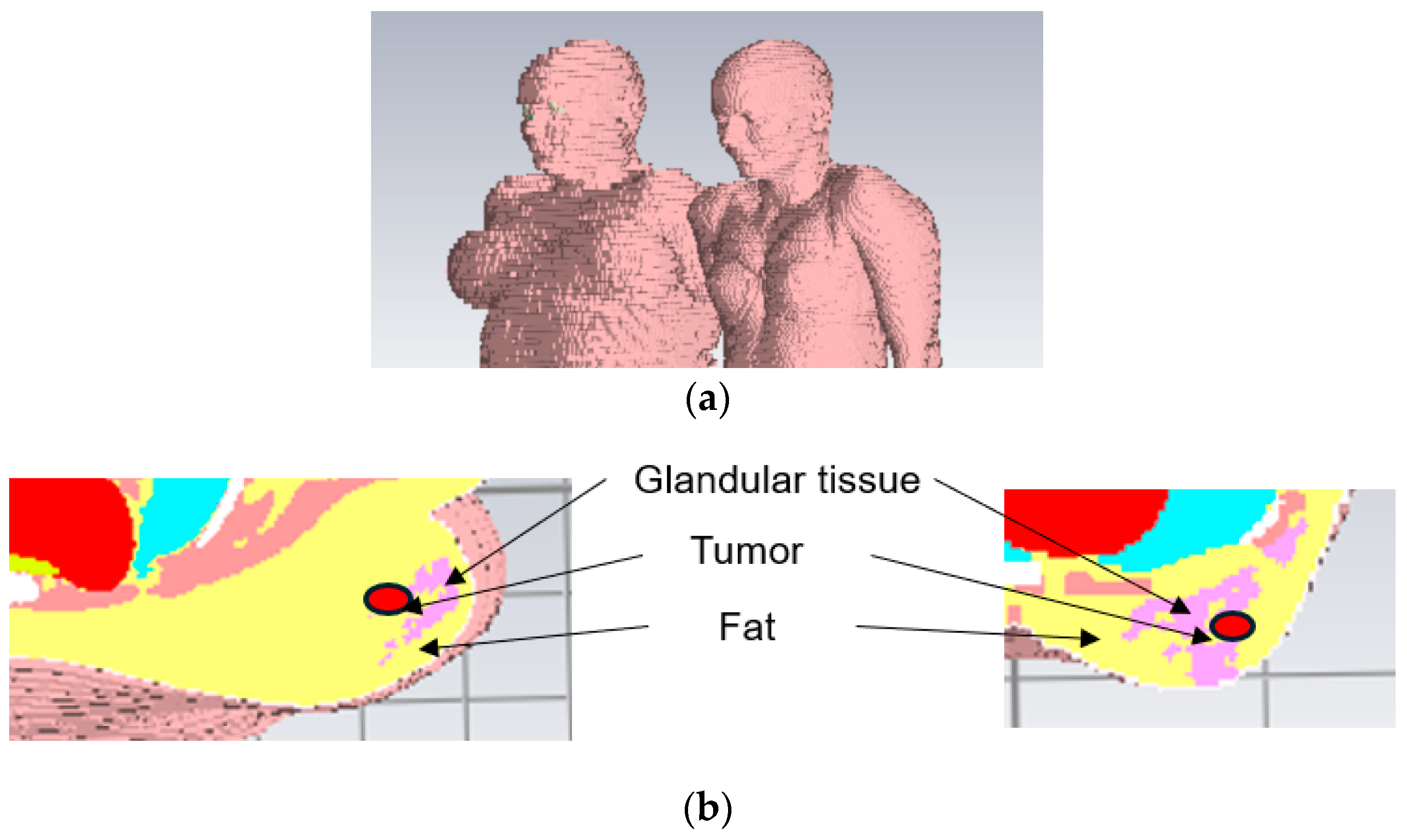 Micromachines 15 01153 g005
