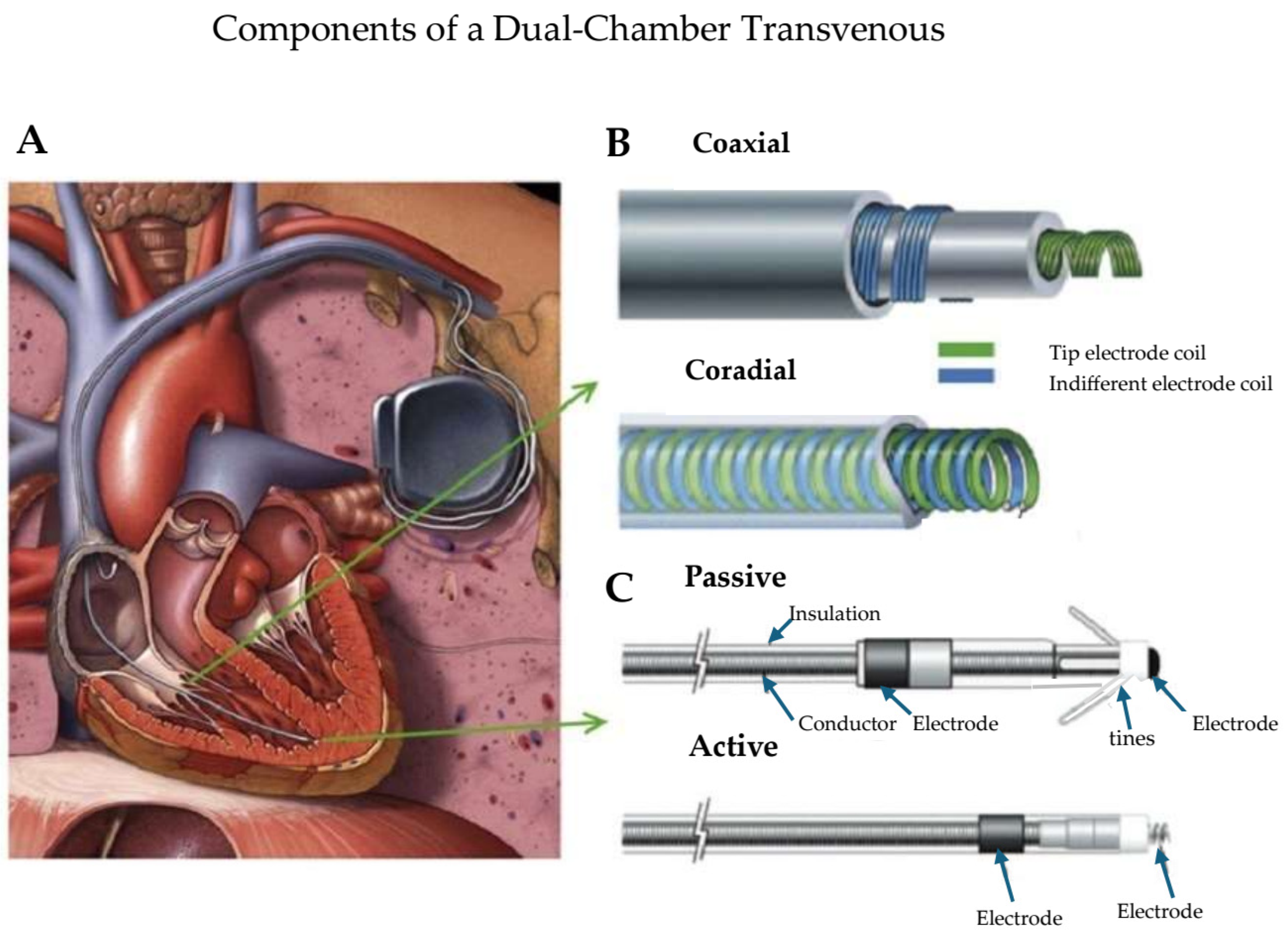 Micromachines 16 00089 g001