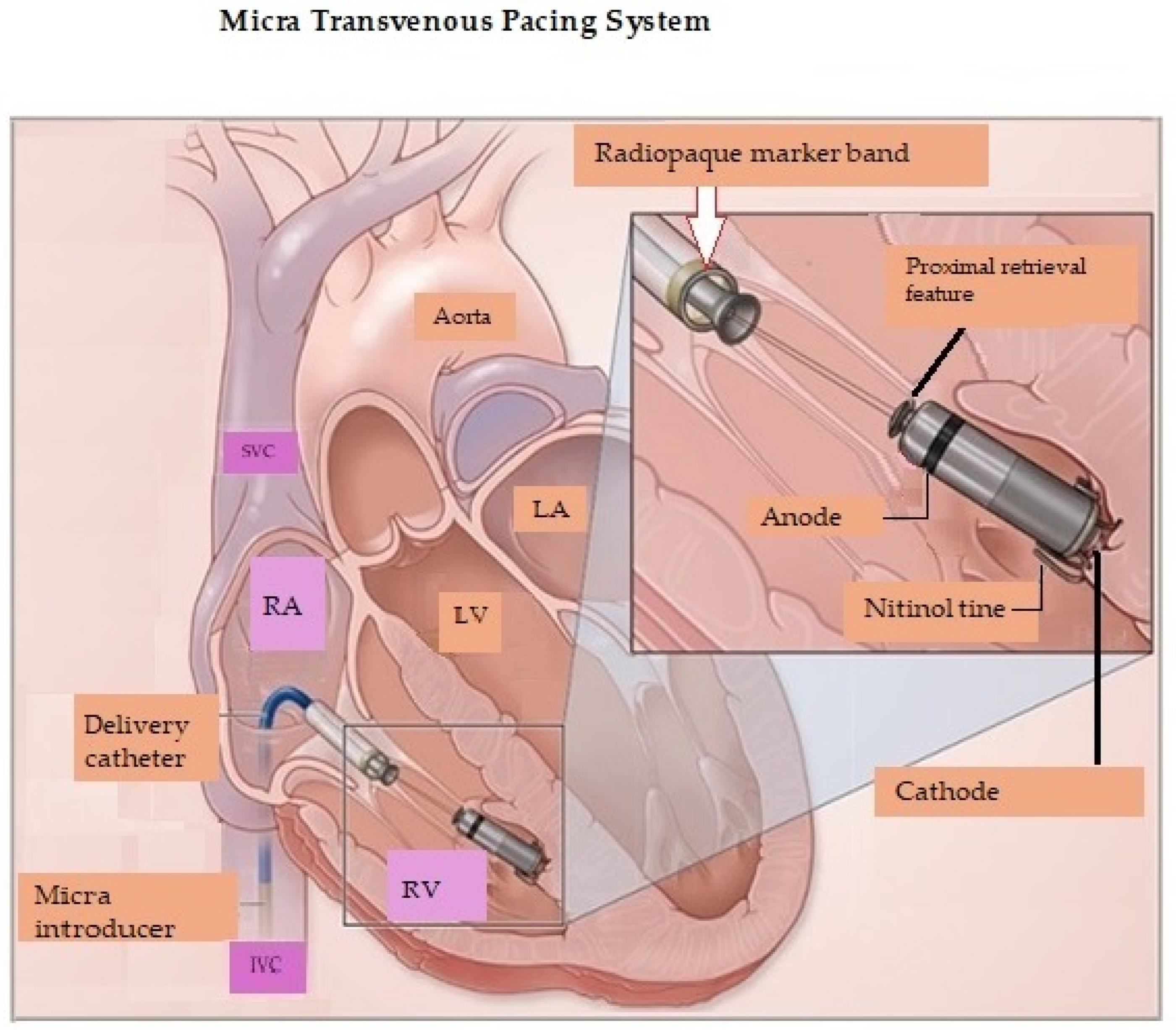 Micromachines 16 00089 g002