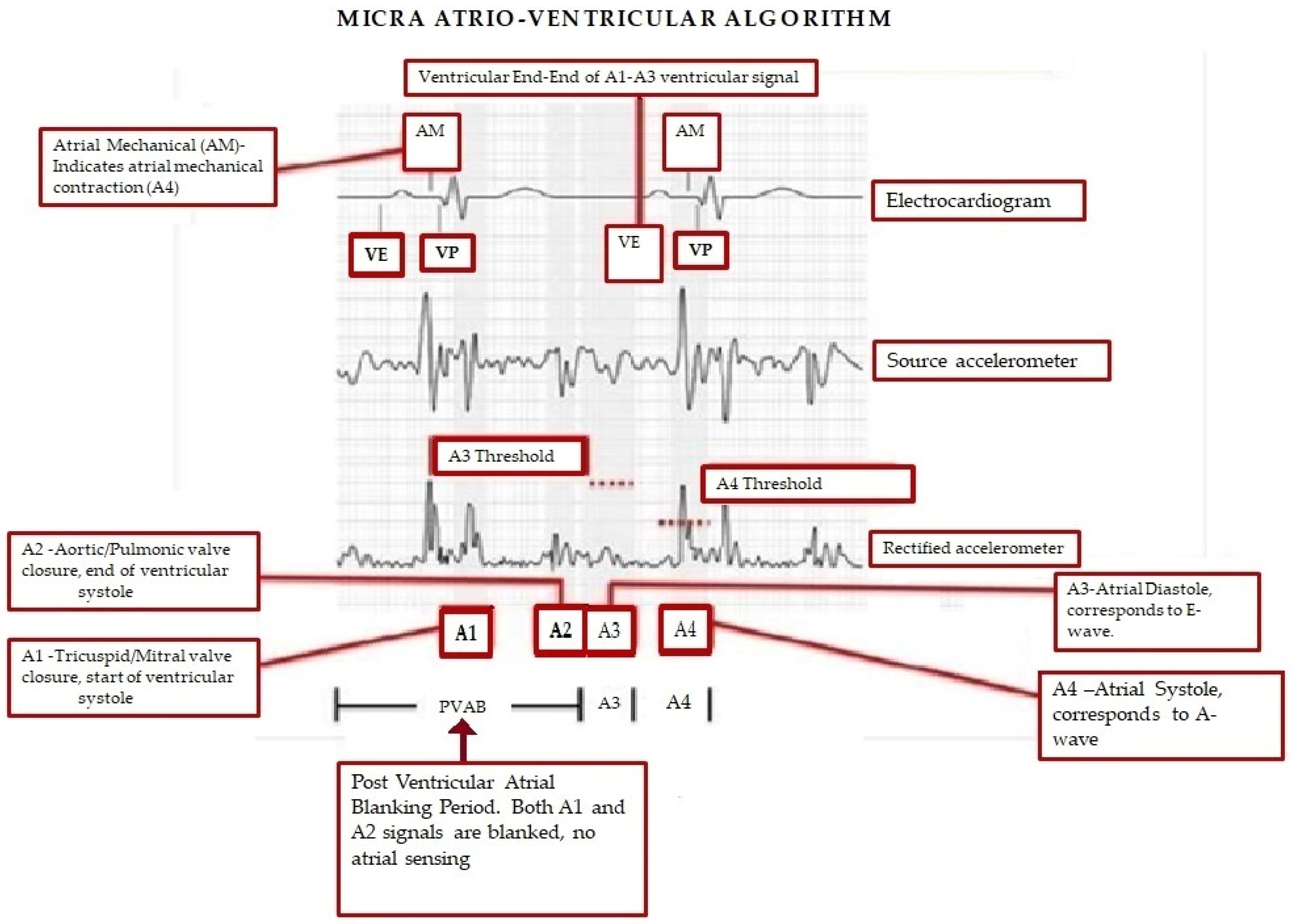 Micromachines 16 00089 g004