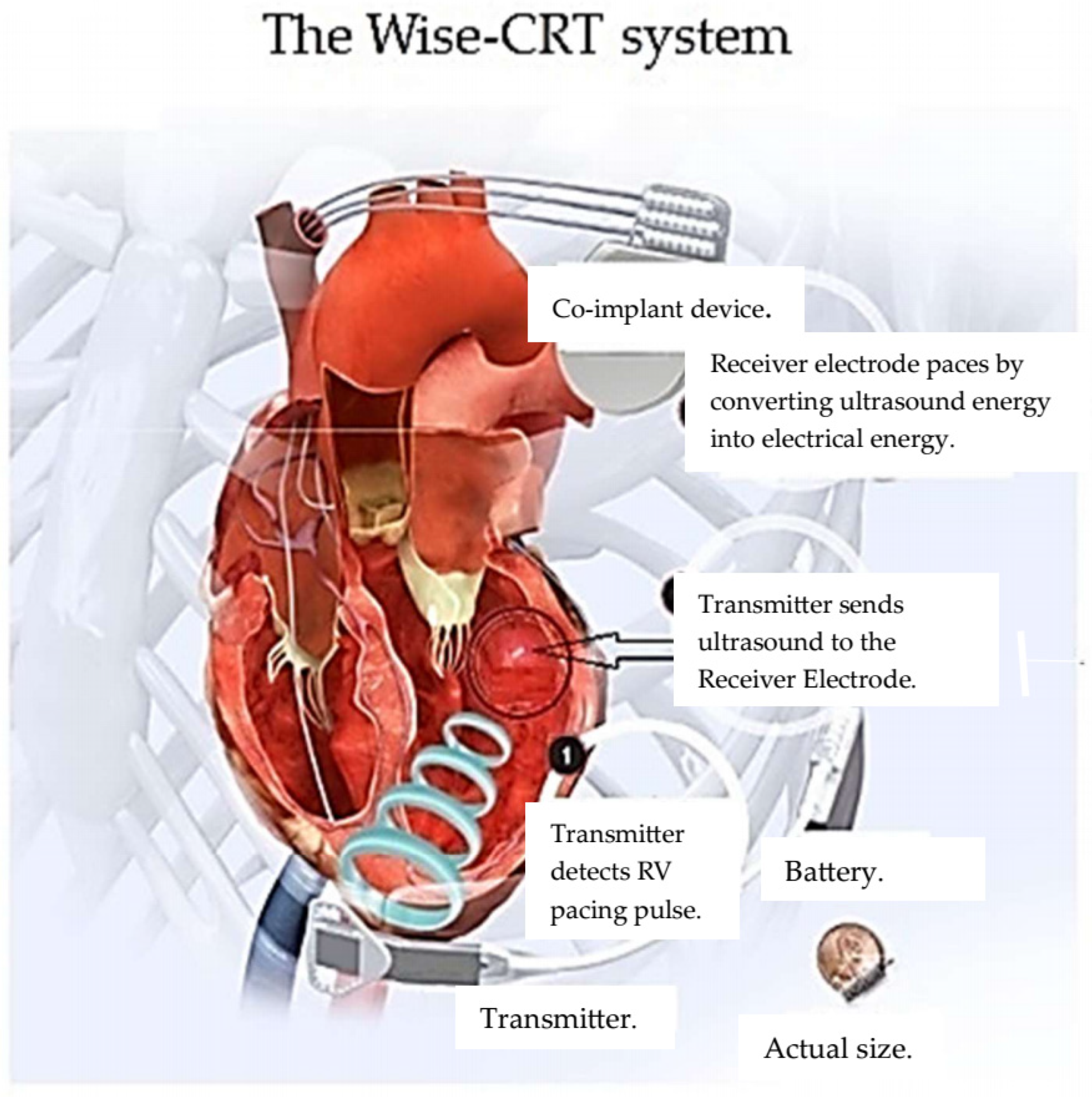 Micromachines 16 00089 g006