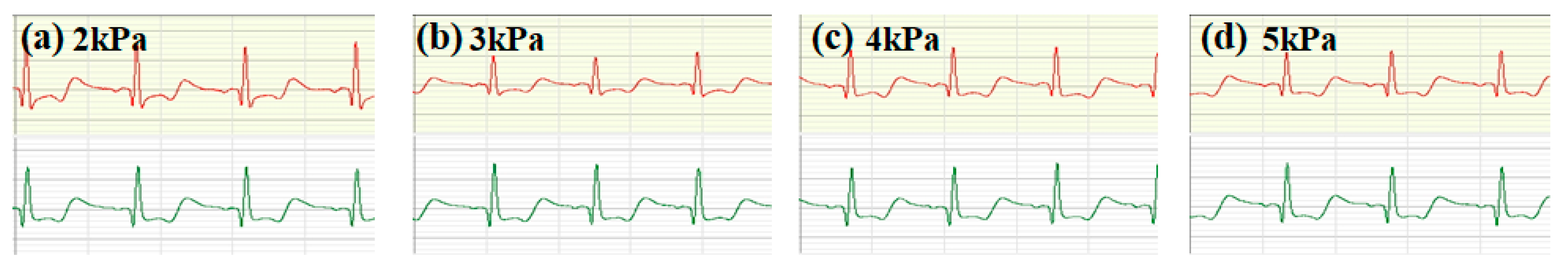 Micromachines 16 00821 g007