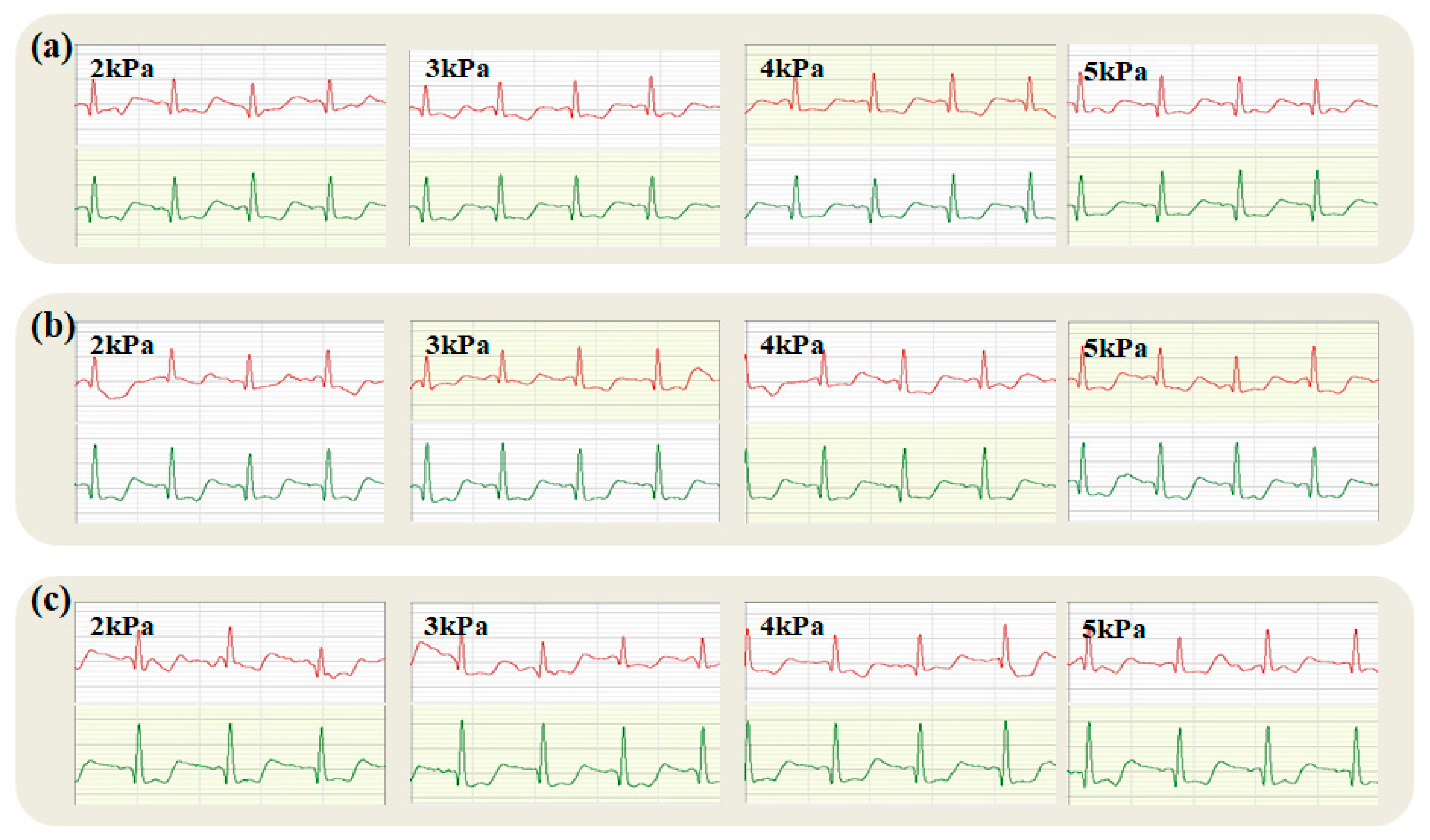 Micromachines 16 00821 g011