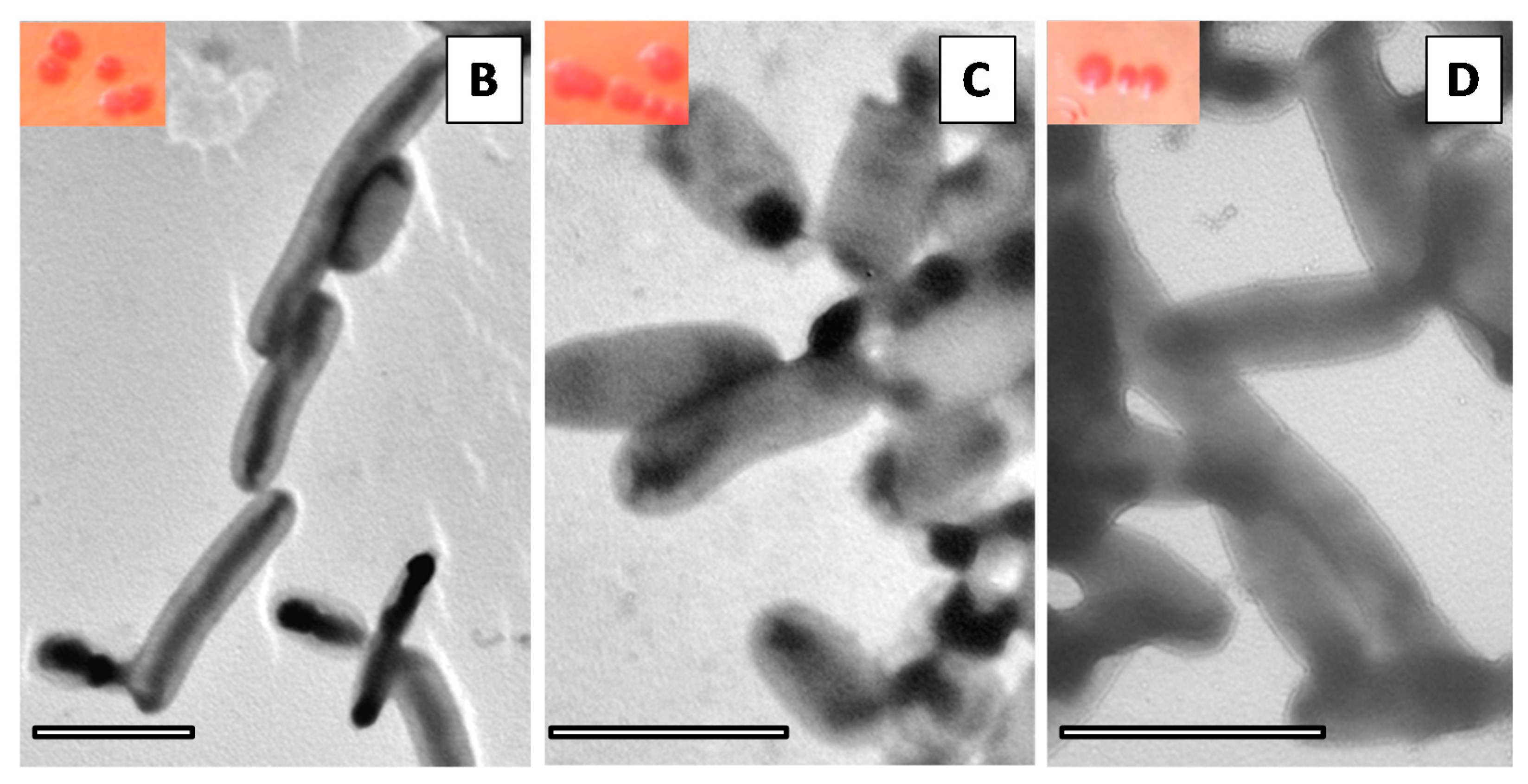 Microorganisms 05 00016 g004b