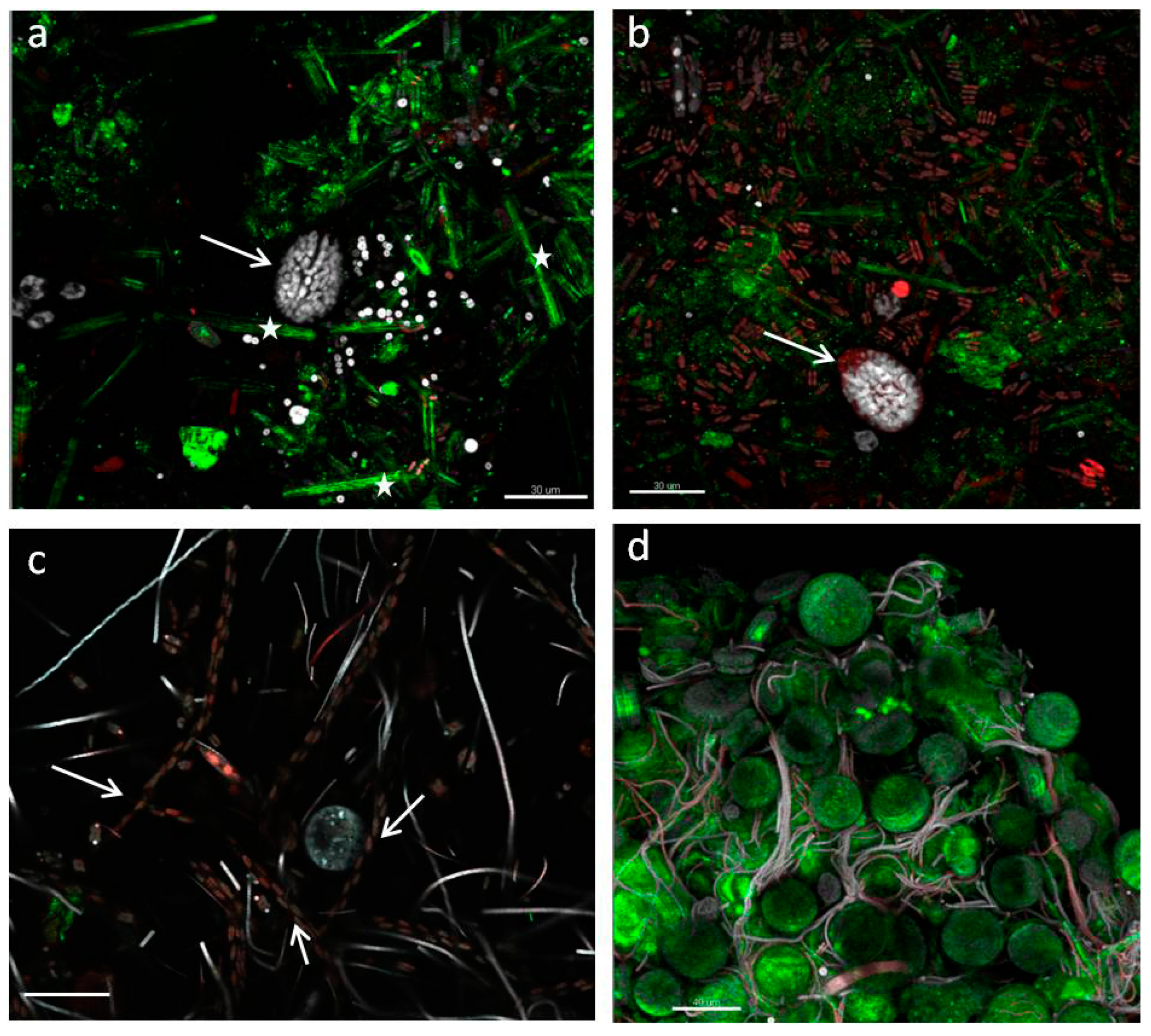 Microorganisms 05 00046 g007