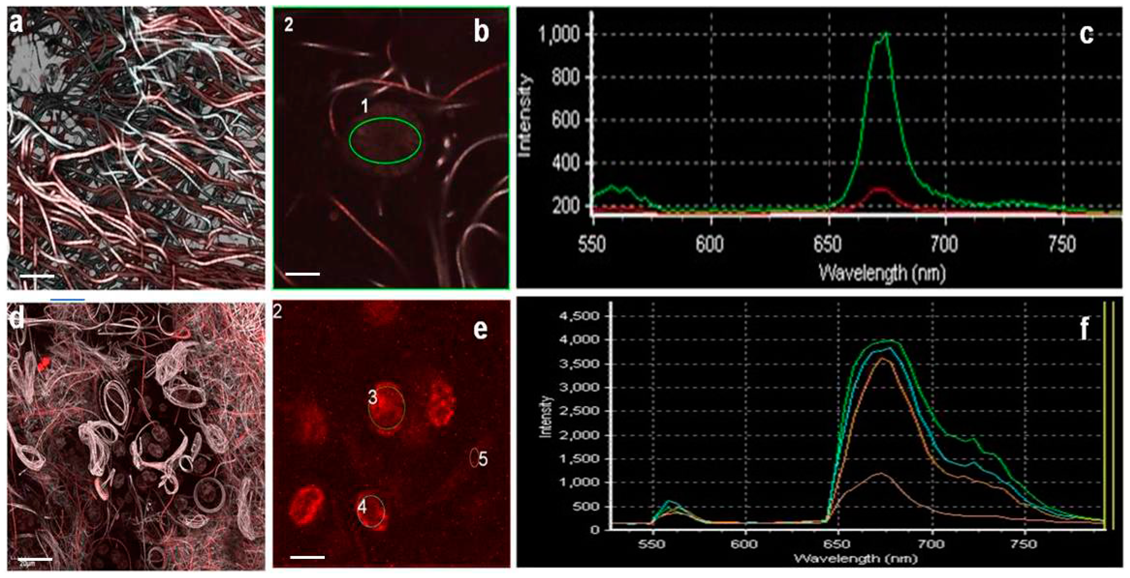 Microorganisms 05 00046 g008