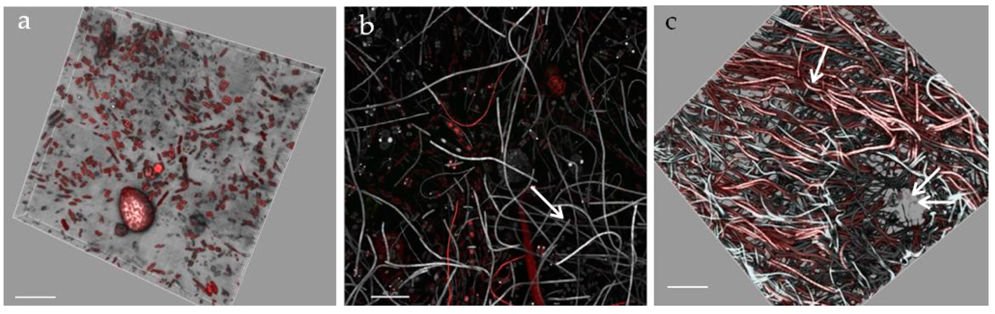 Microorganisms 05 00046 g009