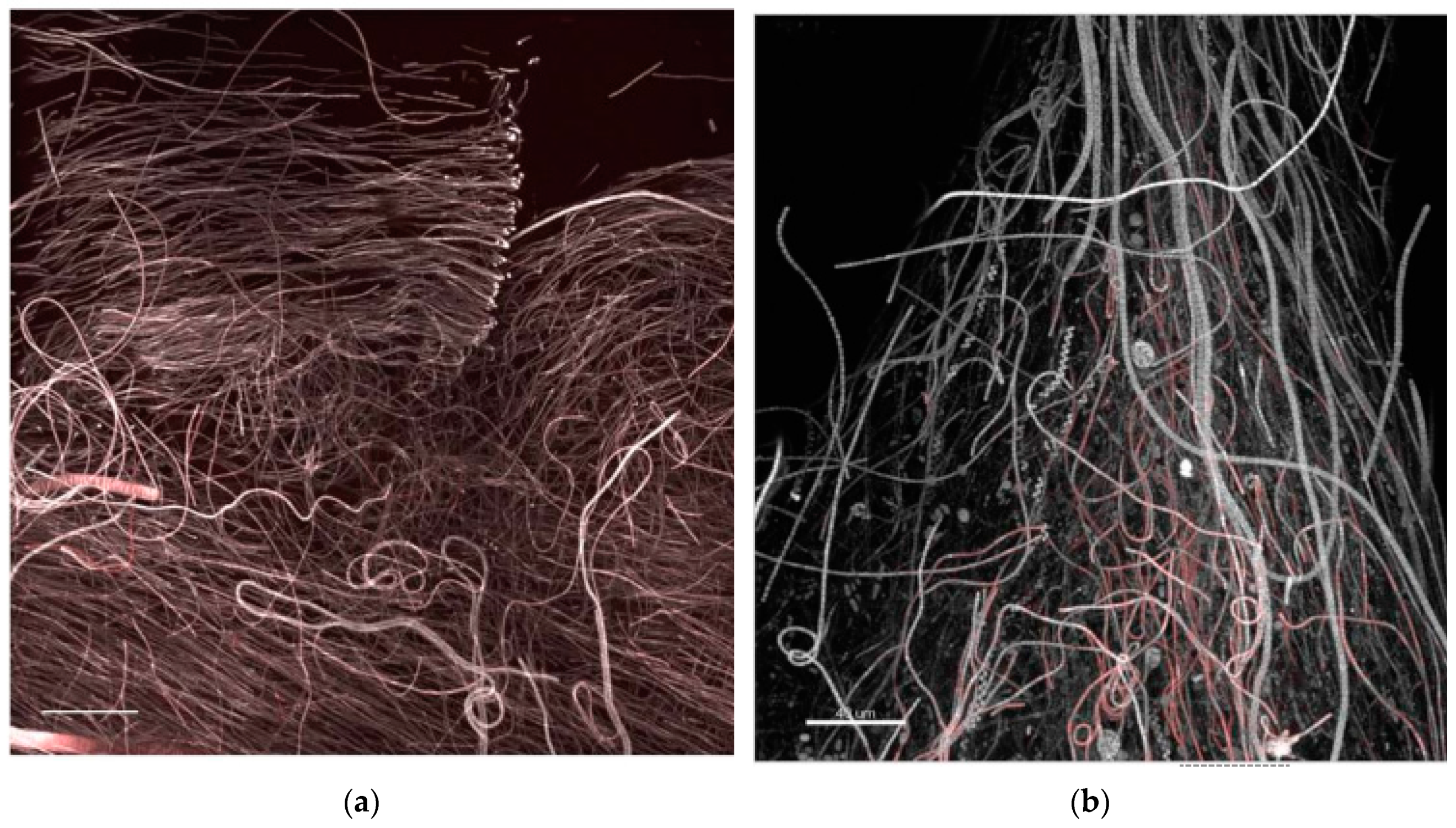 Microorganisms 05 00046 g011