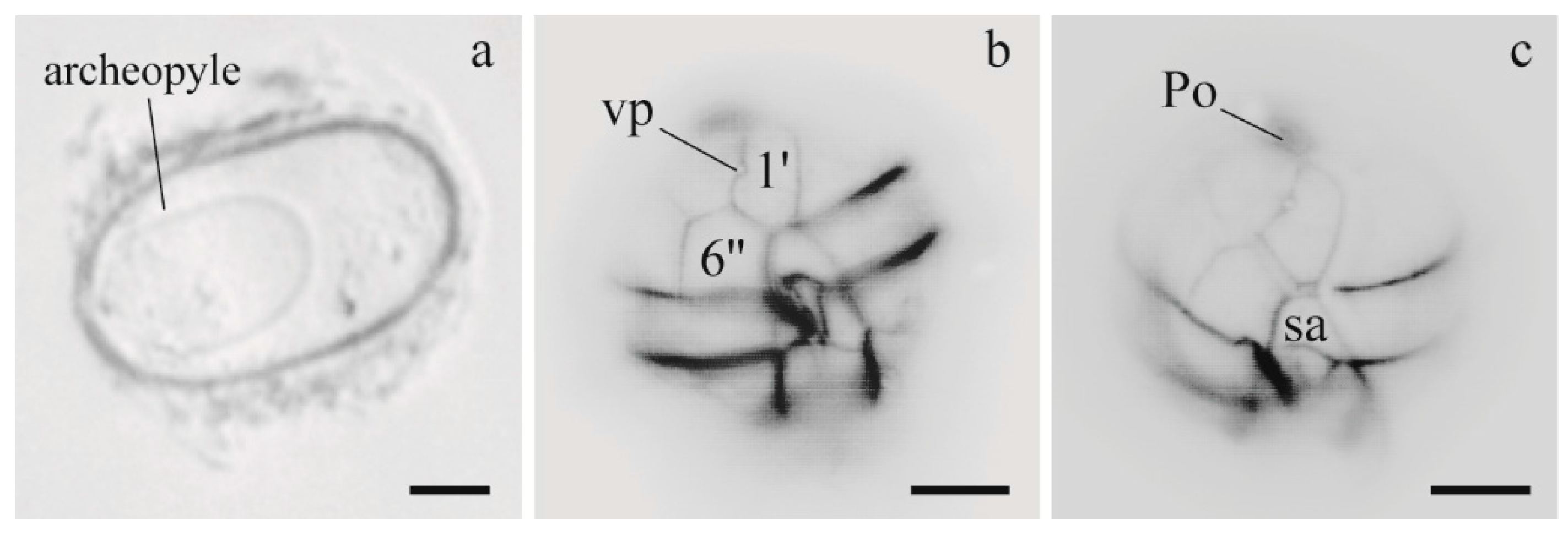 Microorganisms 05 00072 g003