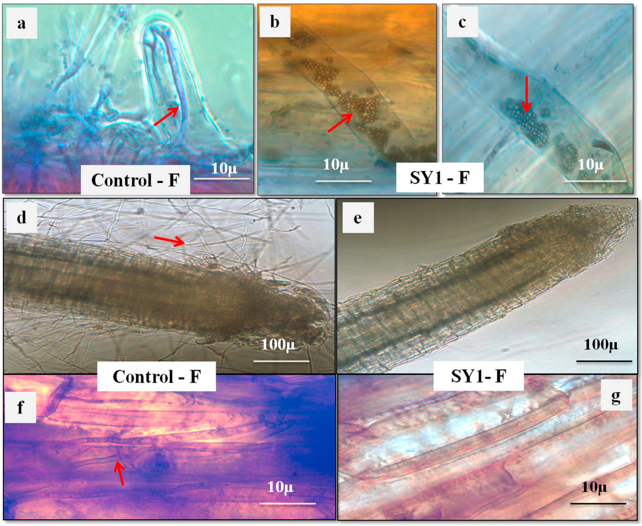 Microorganisms 06 00021 g005