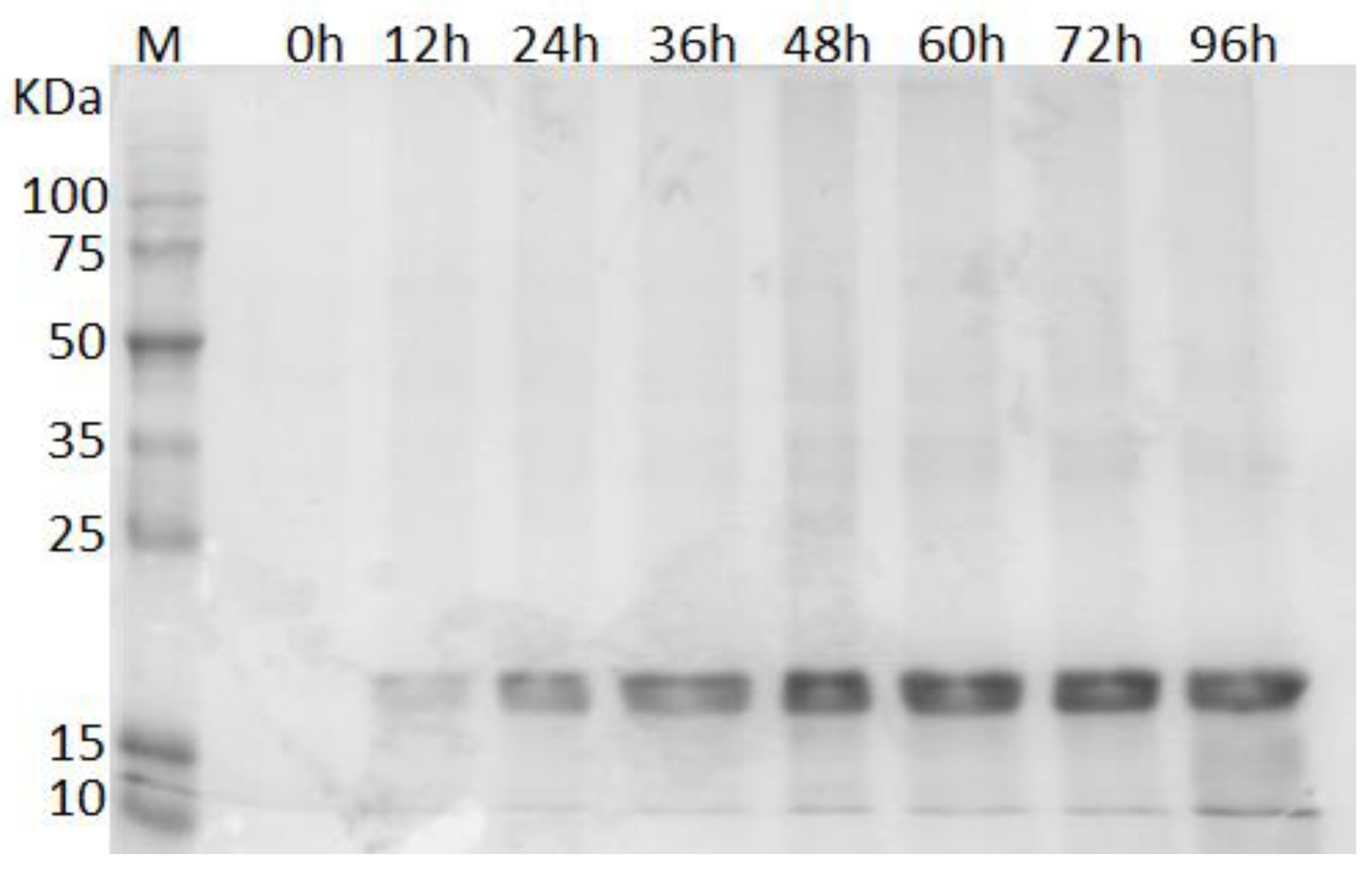 Microorganisms 06 00037 g001
