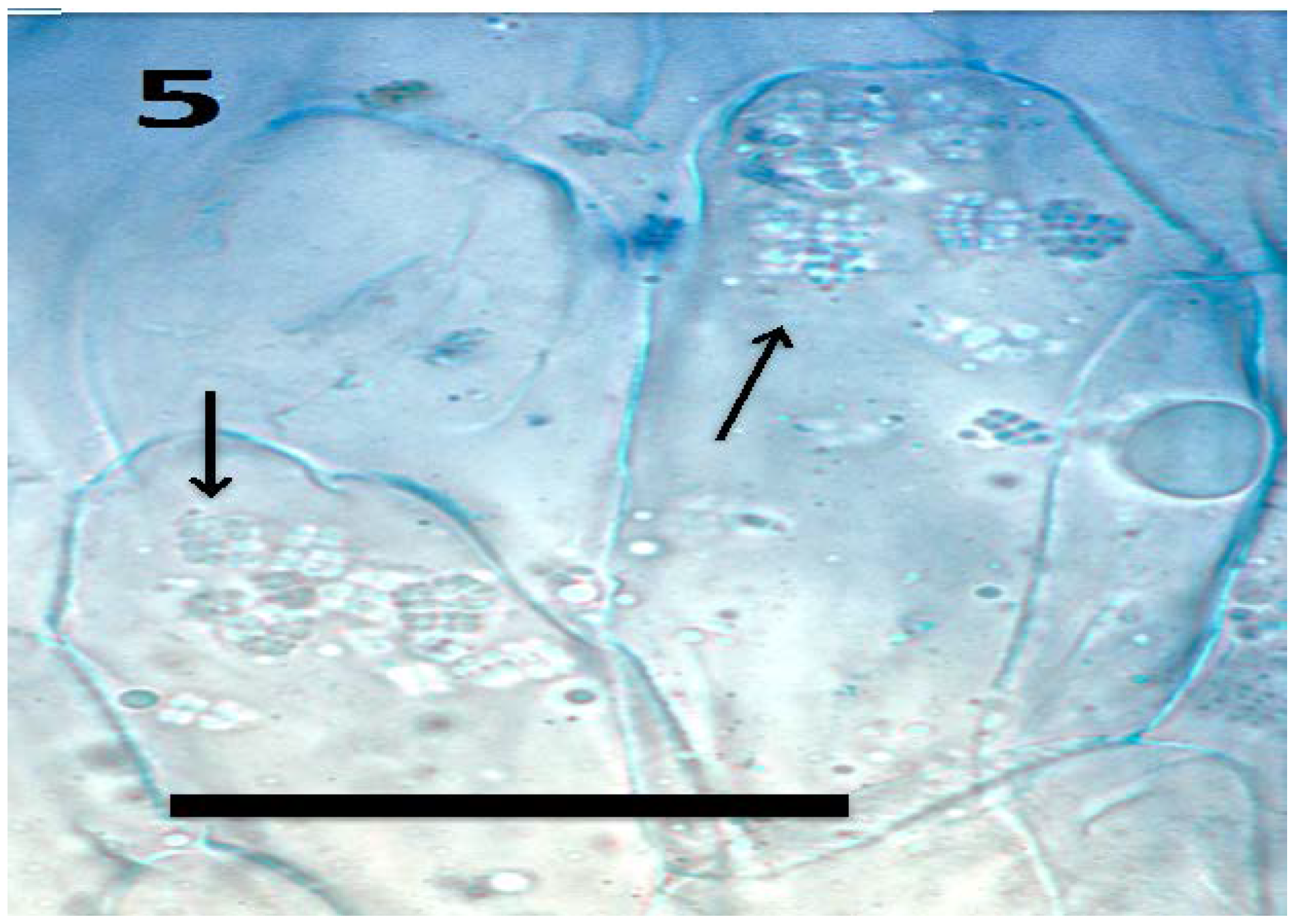 Microorganisms 06 00095 g005