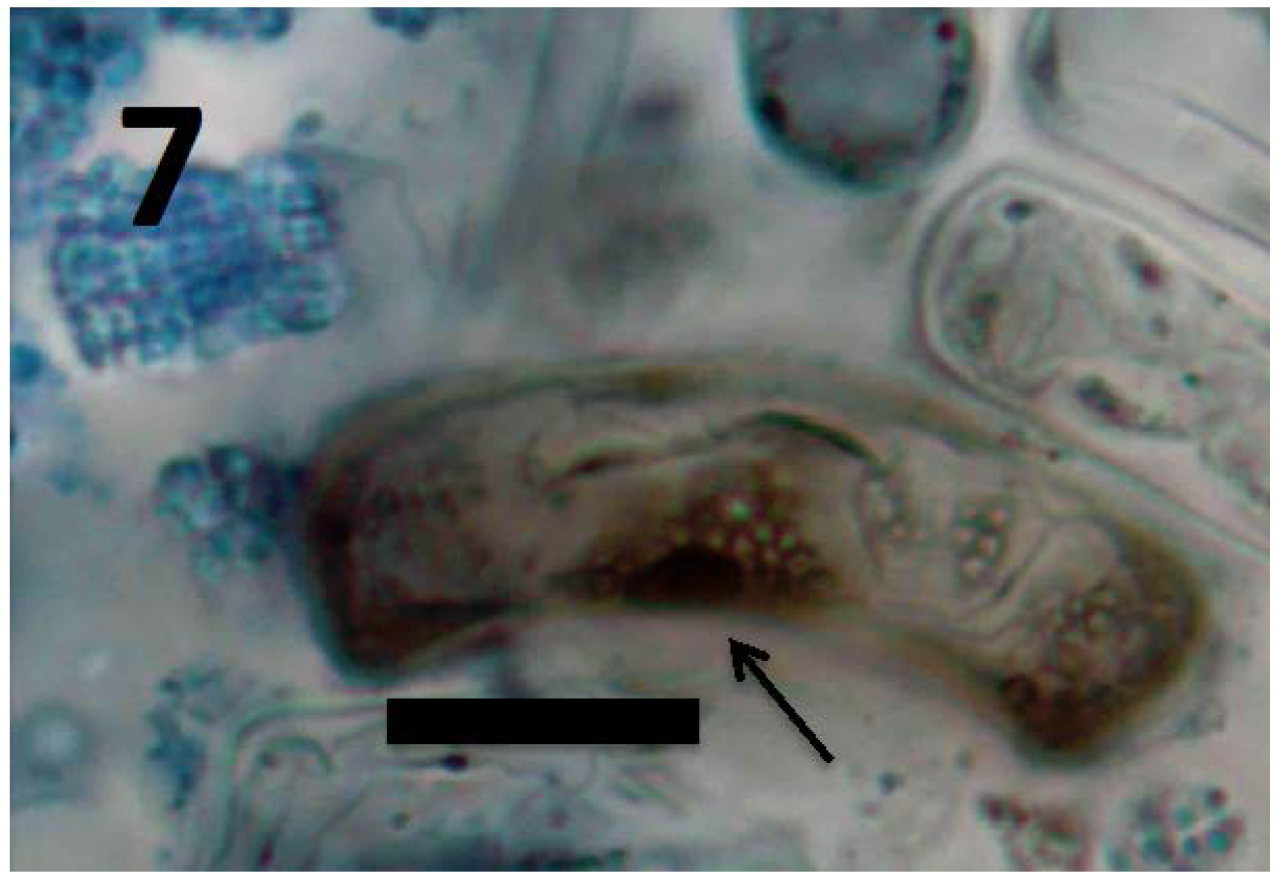 Microorganisms 06 00095 g007