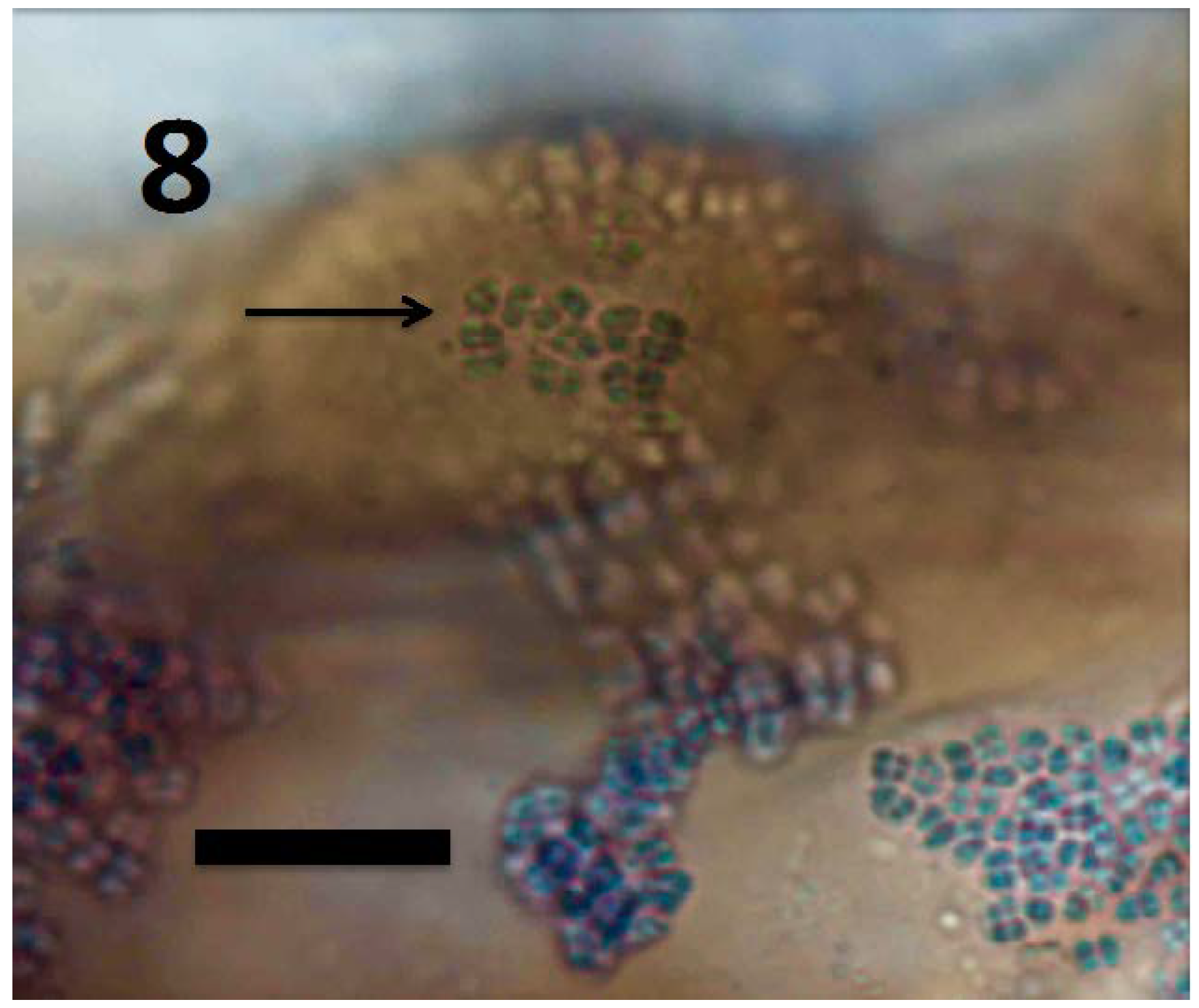 Microorganisms 06 00095 g008