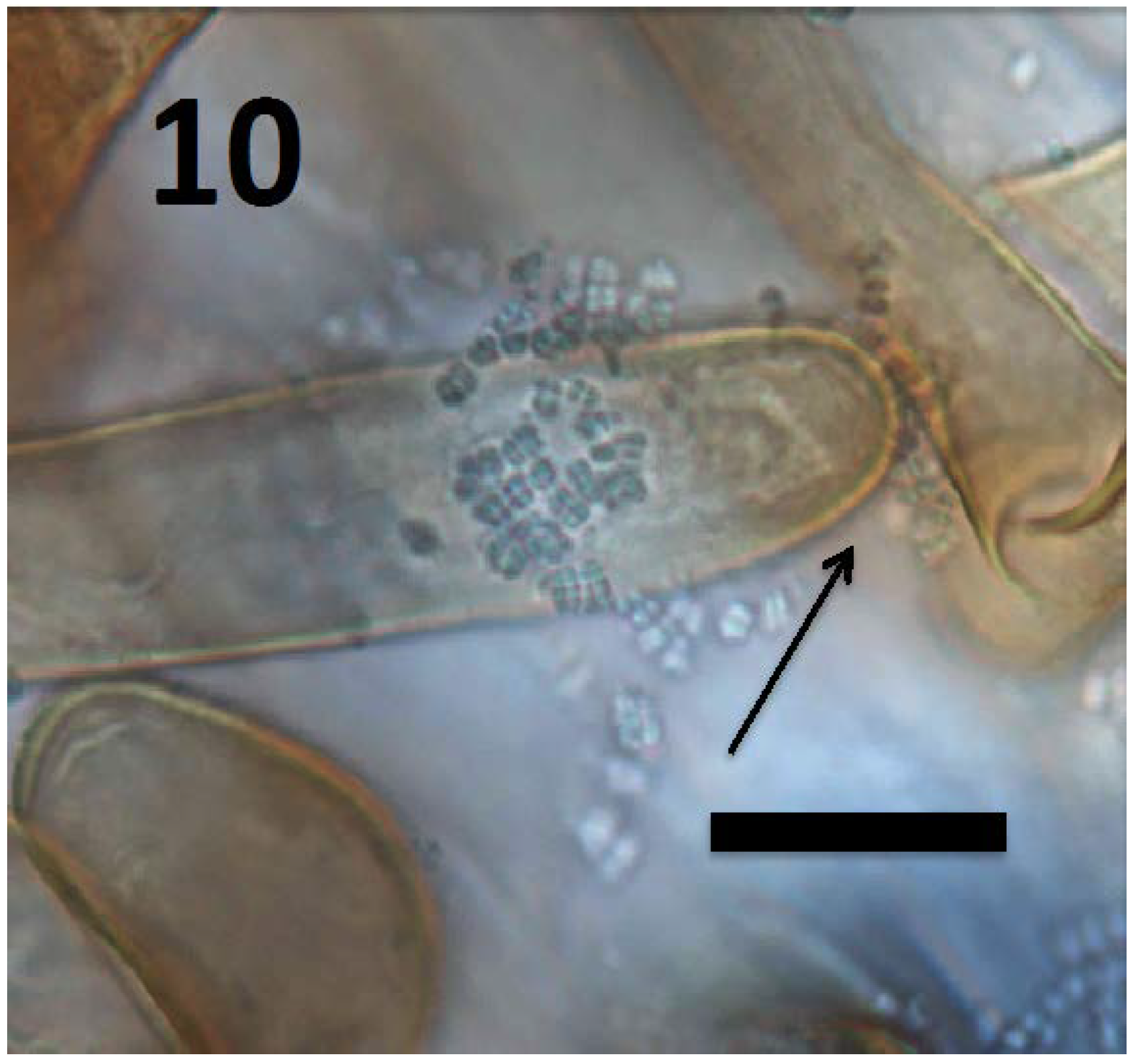 Microorganisms 06 00095 g010